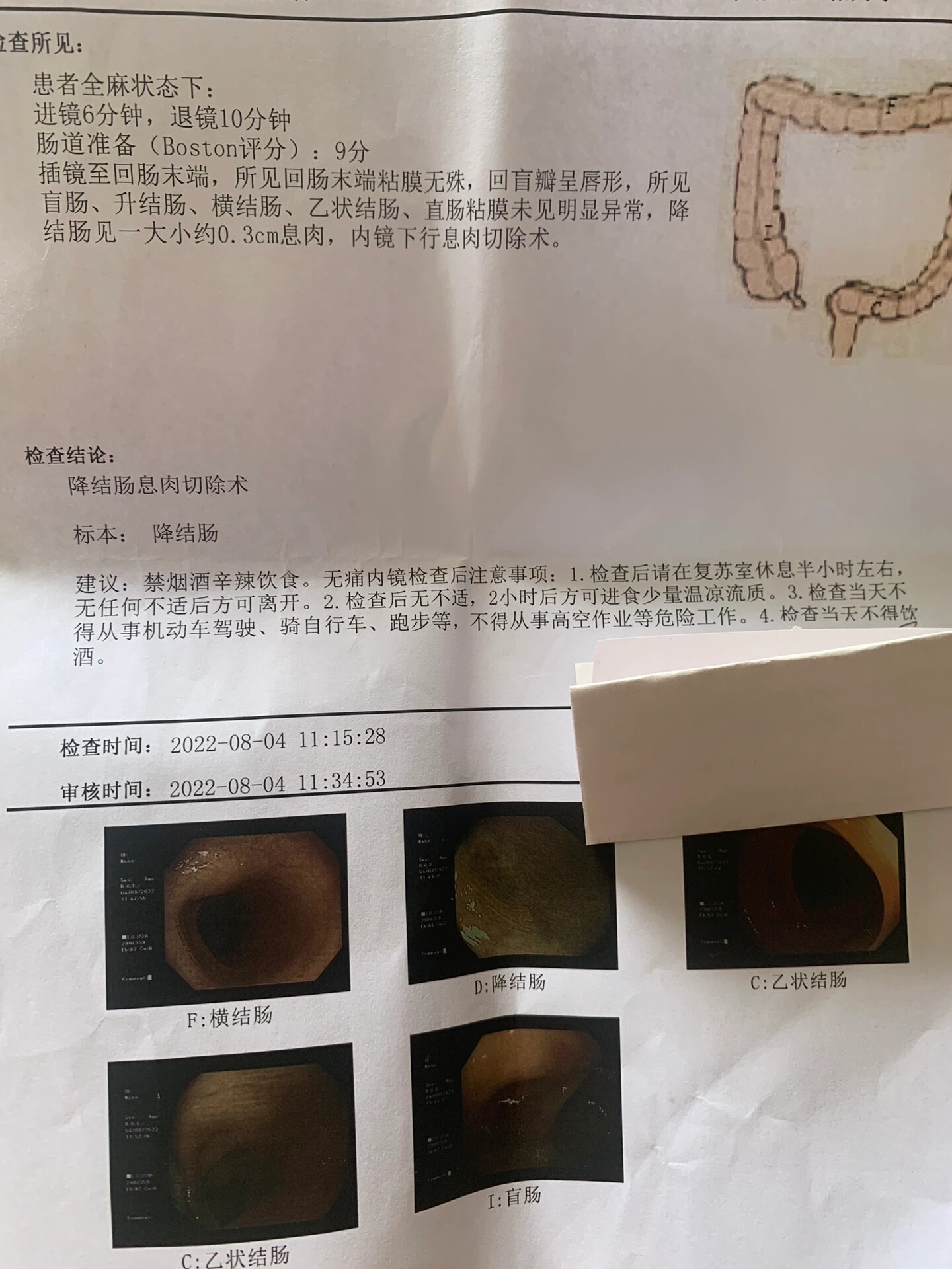 慢性萎缩性胃炎c3伴肠化