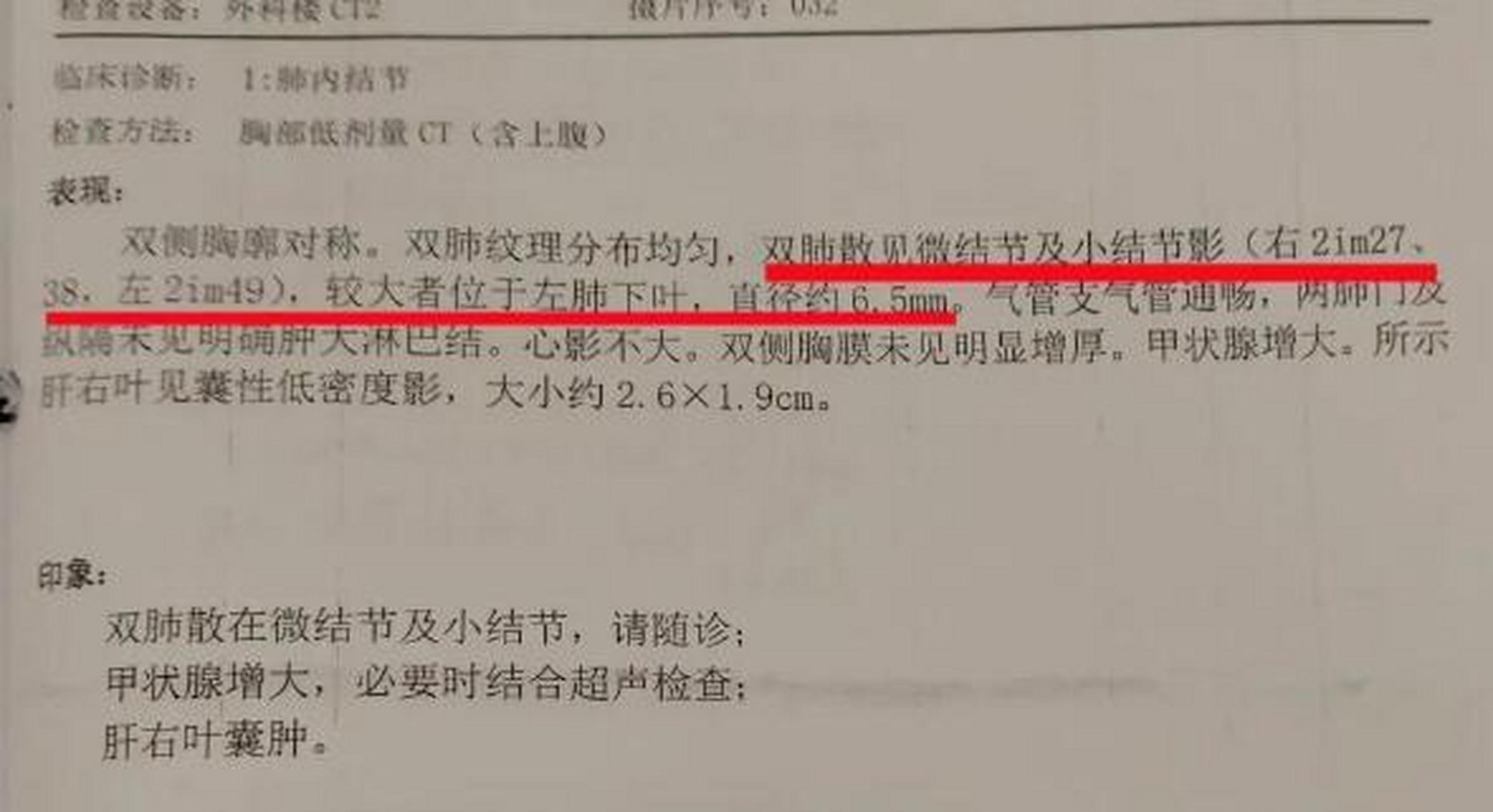 查出肺結節不用怕,小小一把魚腥草,是散結的好寶貝 魚腥草是一味草藥