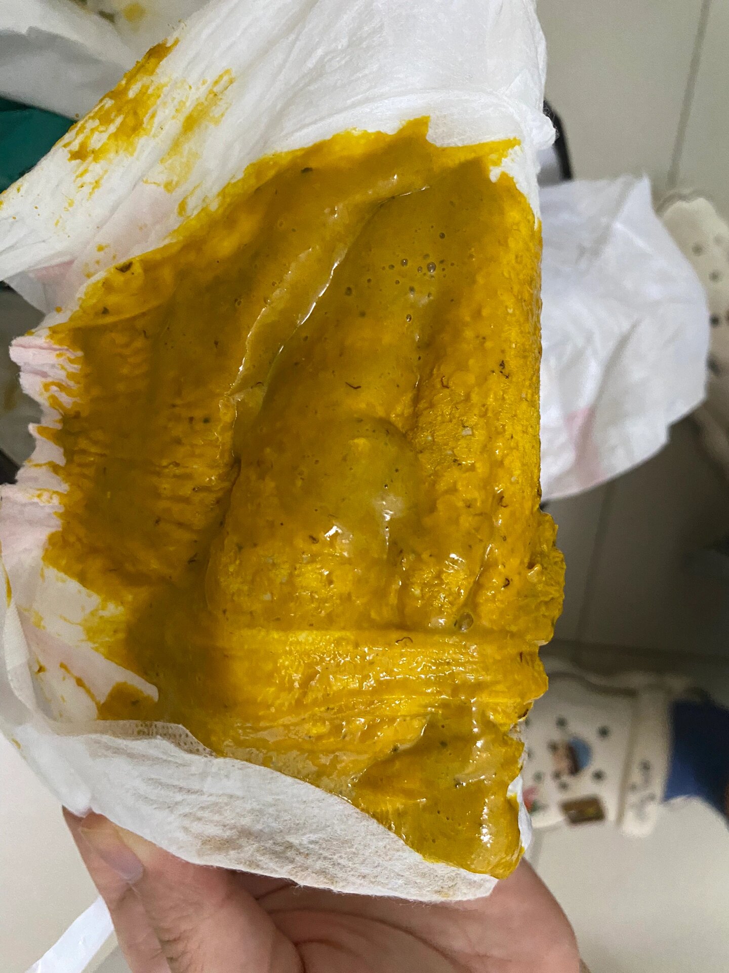 6个月宝宝大便后有褐色丝状物?求解