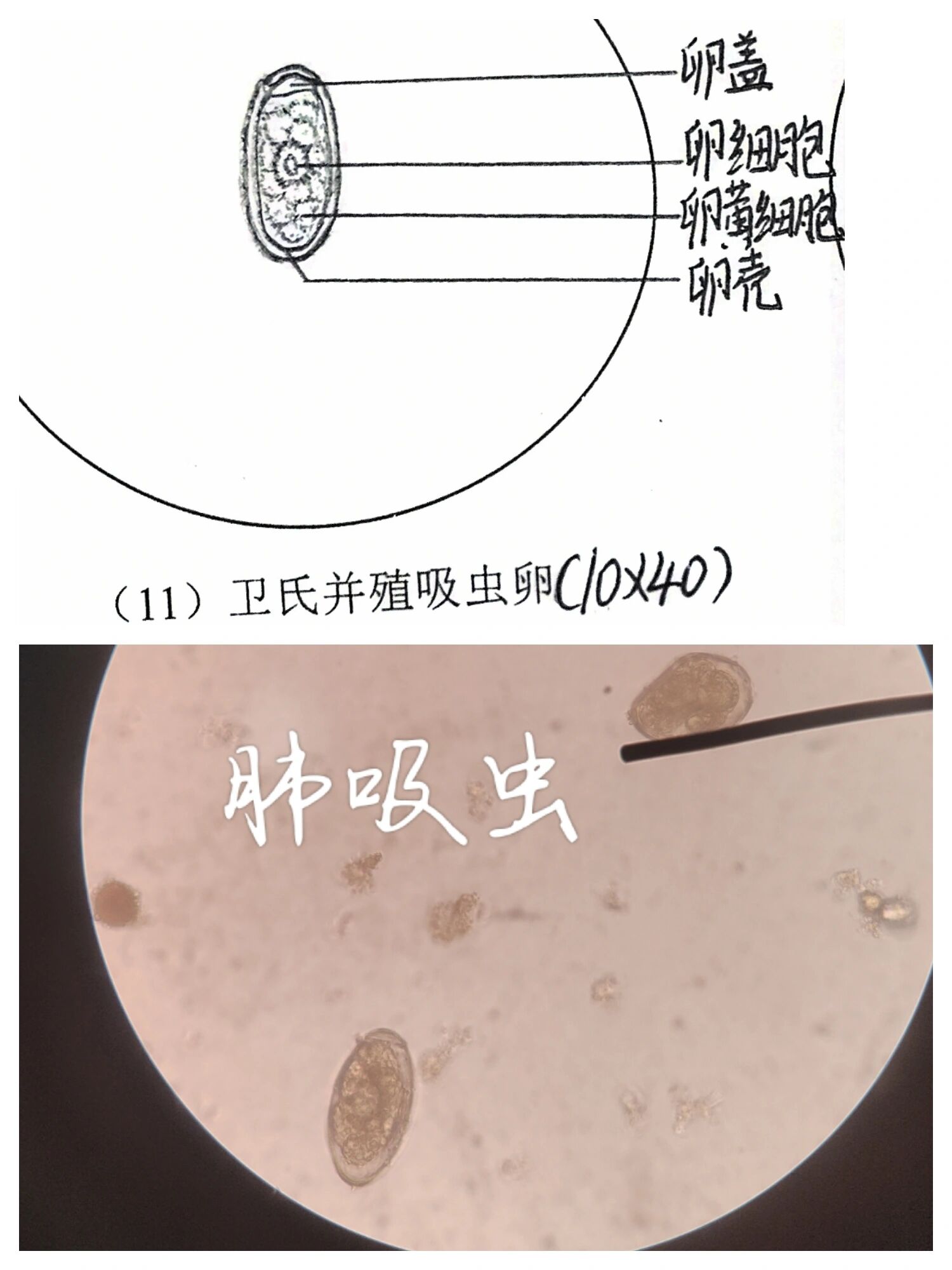 肺吸虫虫卵手绘图图片