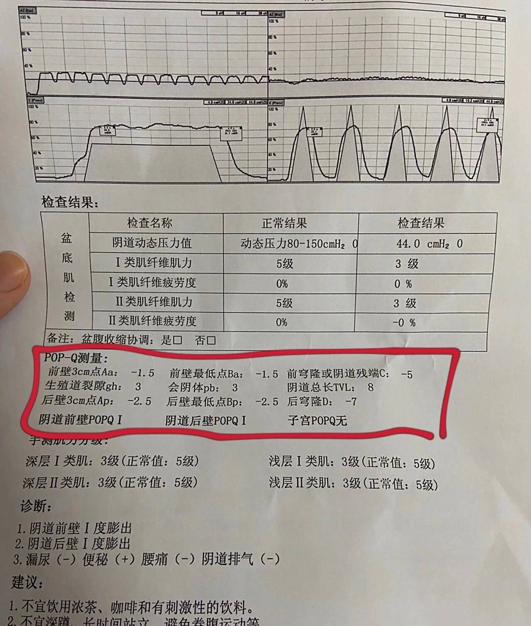pop-q盆底肌报告的解读 pop-q报告的解读,相信很多宝妈看到这样的报告