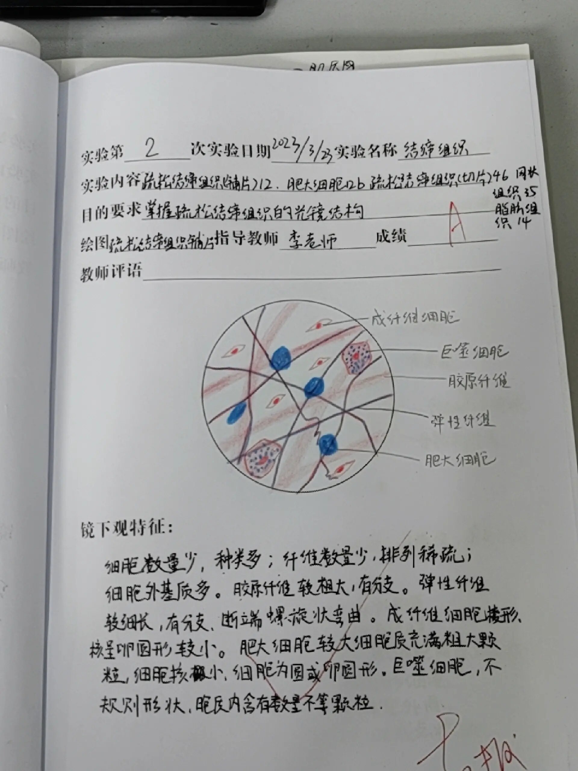 结缔组织图片 手绘图图片