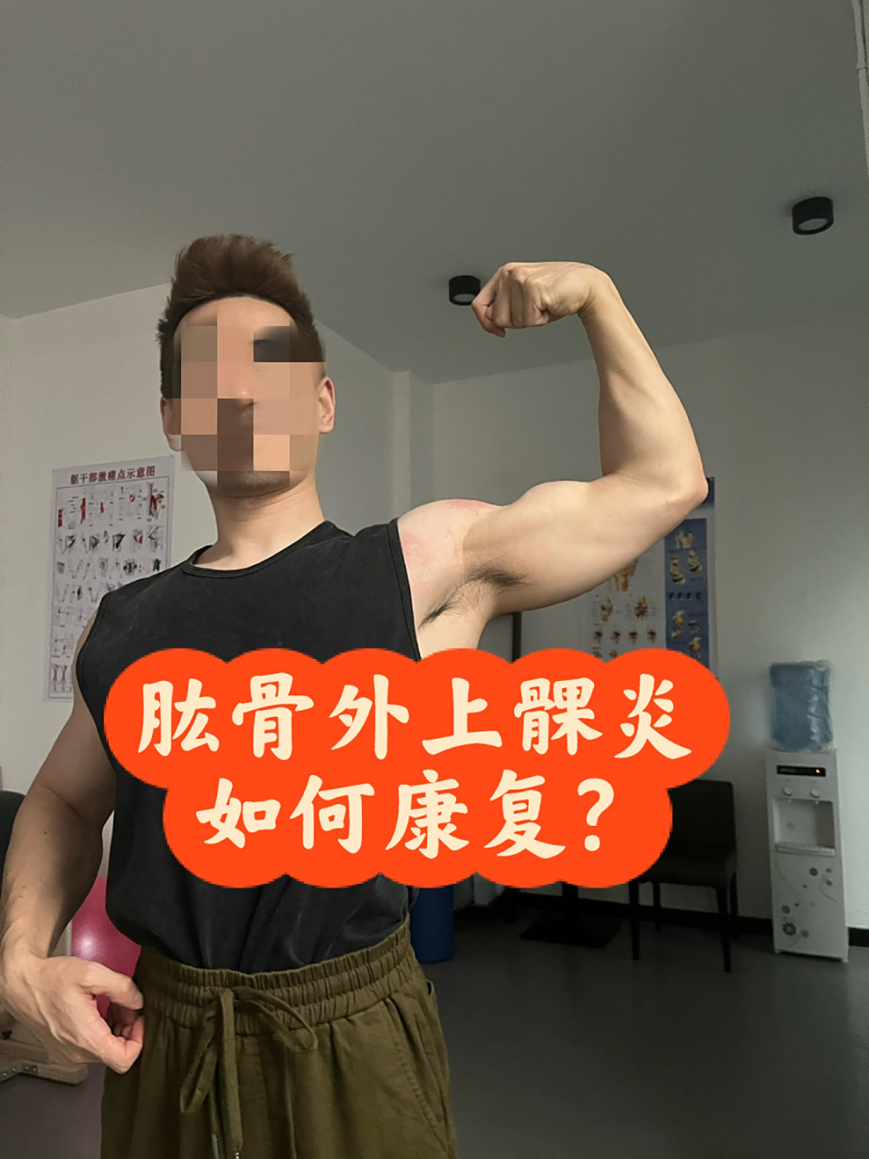 肱骨外上髁炎77手指麻木如何解决?