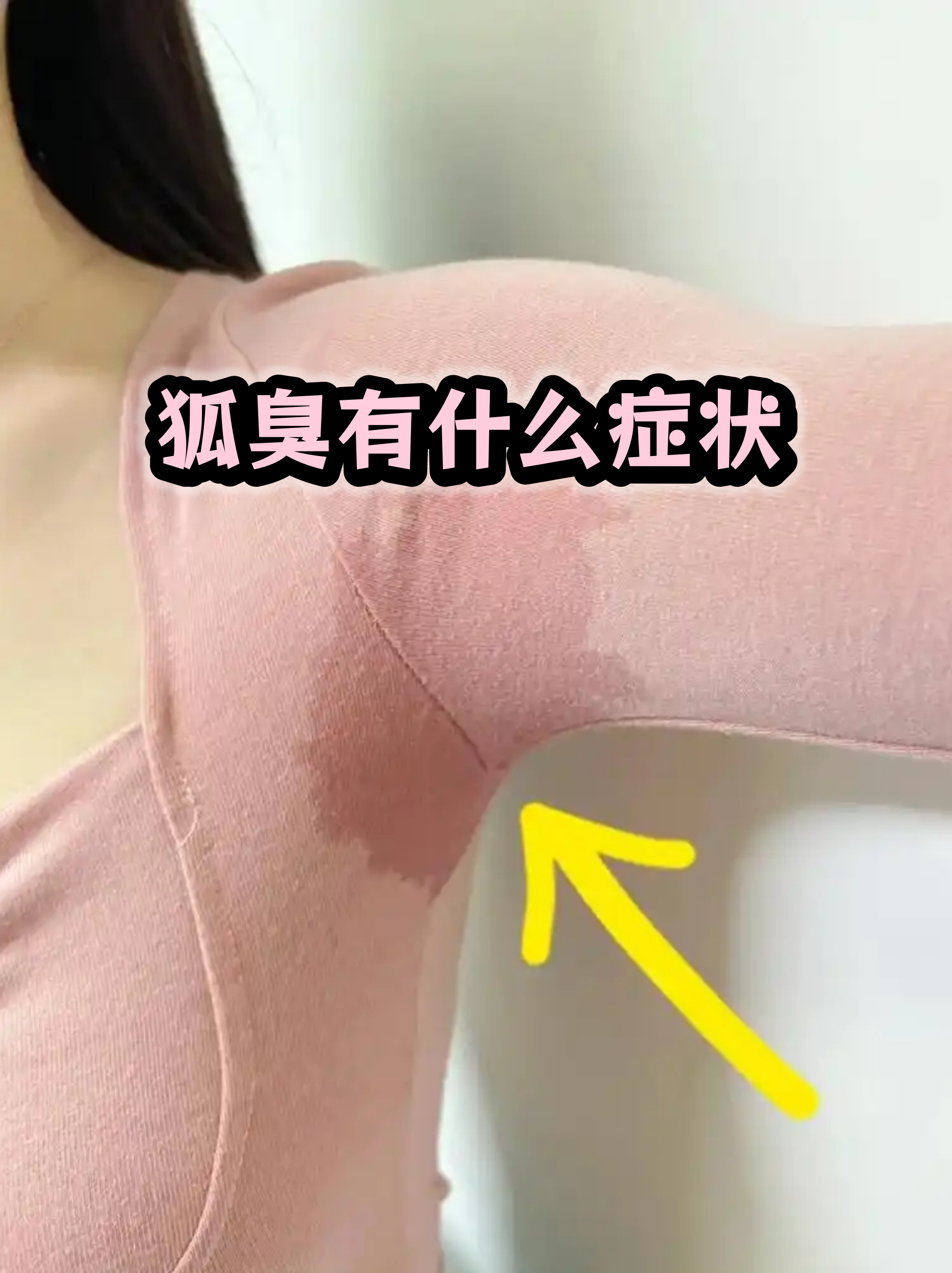 狐臭和正常人腋窝图片(狐臭和正常人腋窝图片 原理图)
