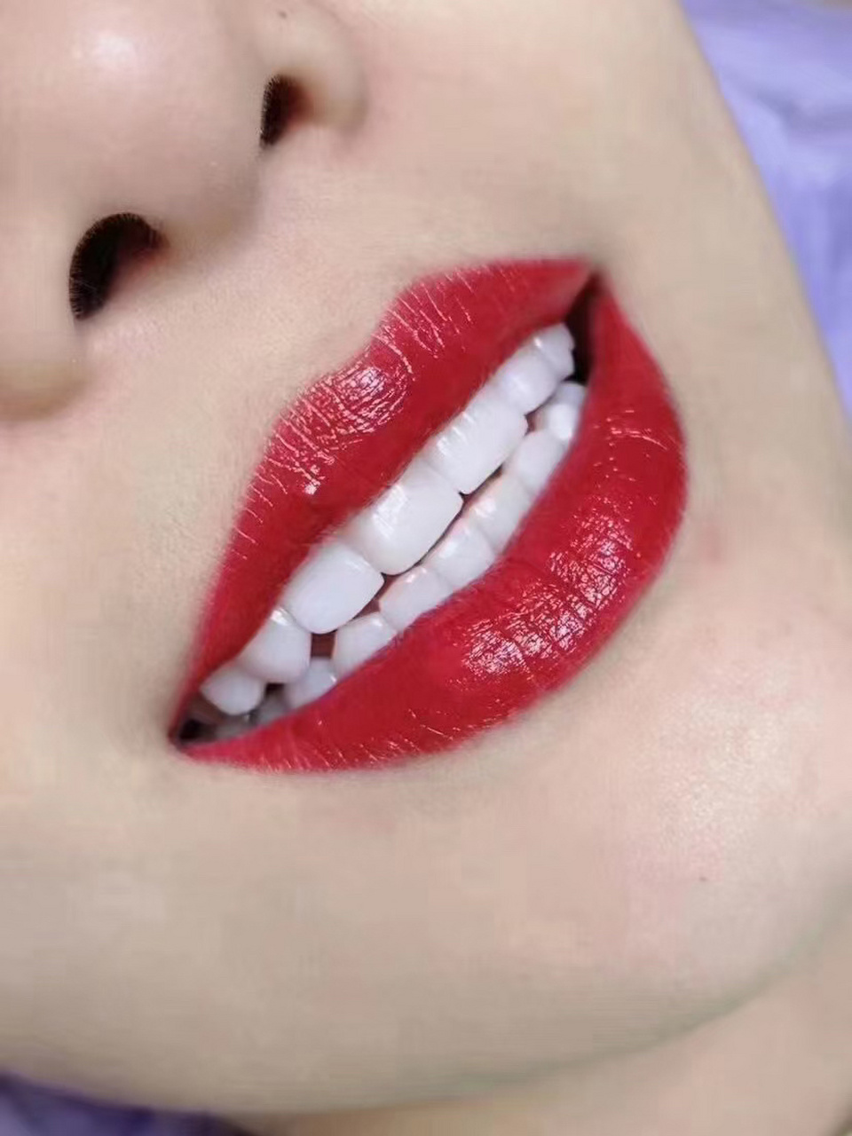 美牙文案 ‖ の 美业朋友圈高级感文案 07普及一