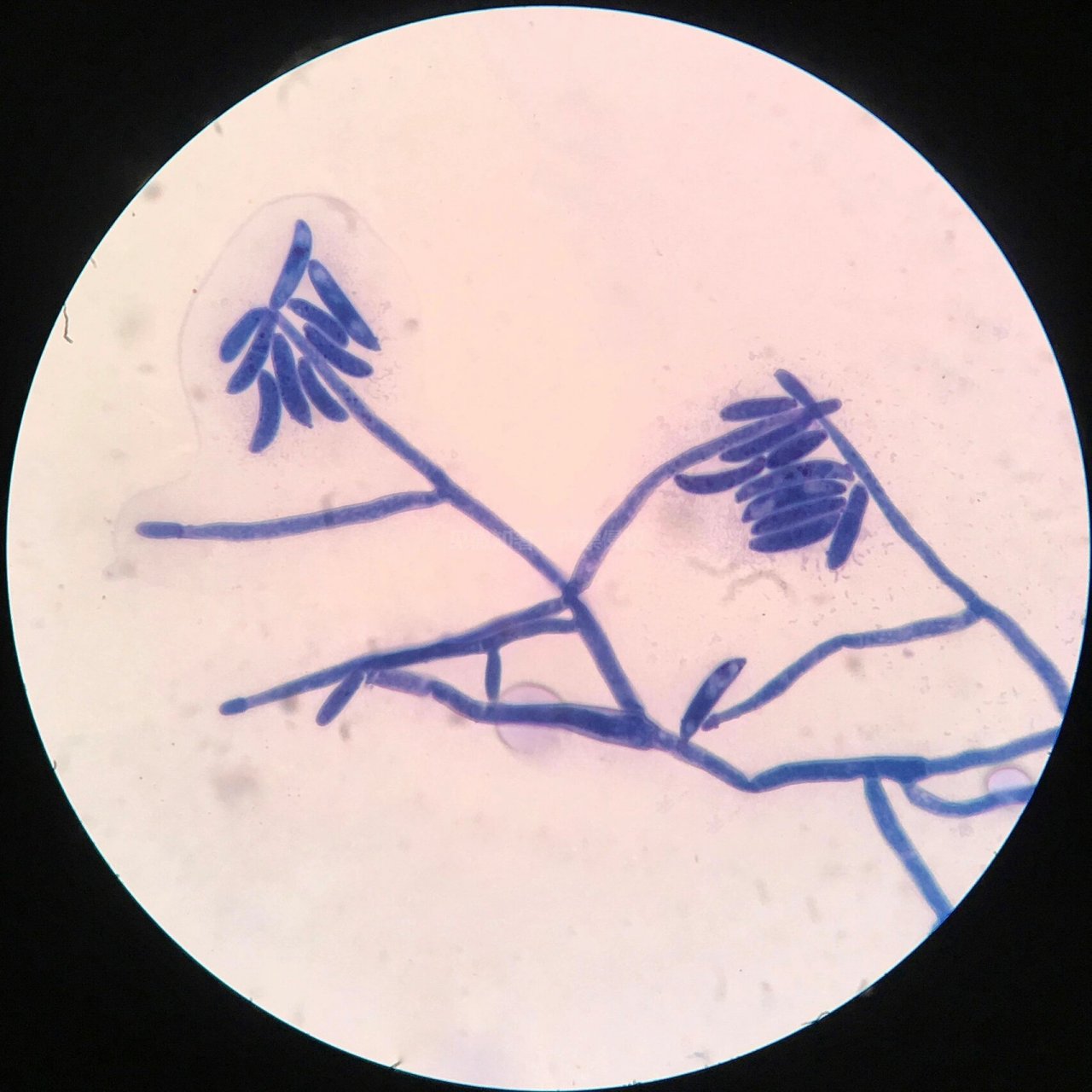 大分生孢子显微镜图片图片