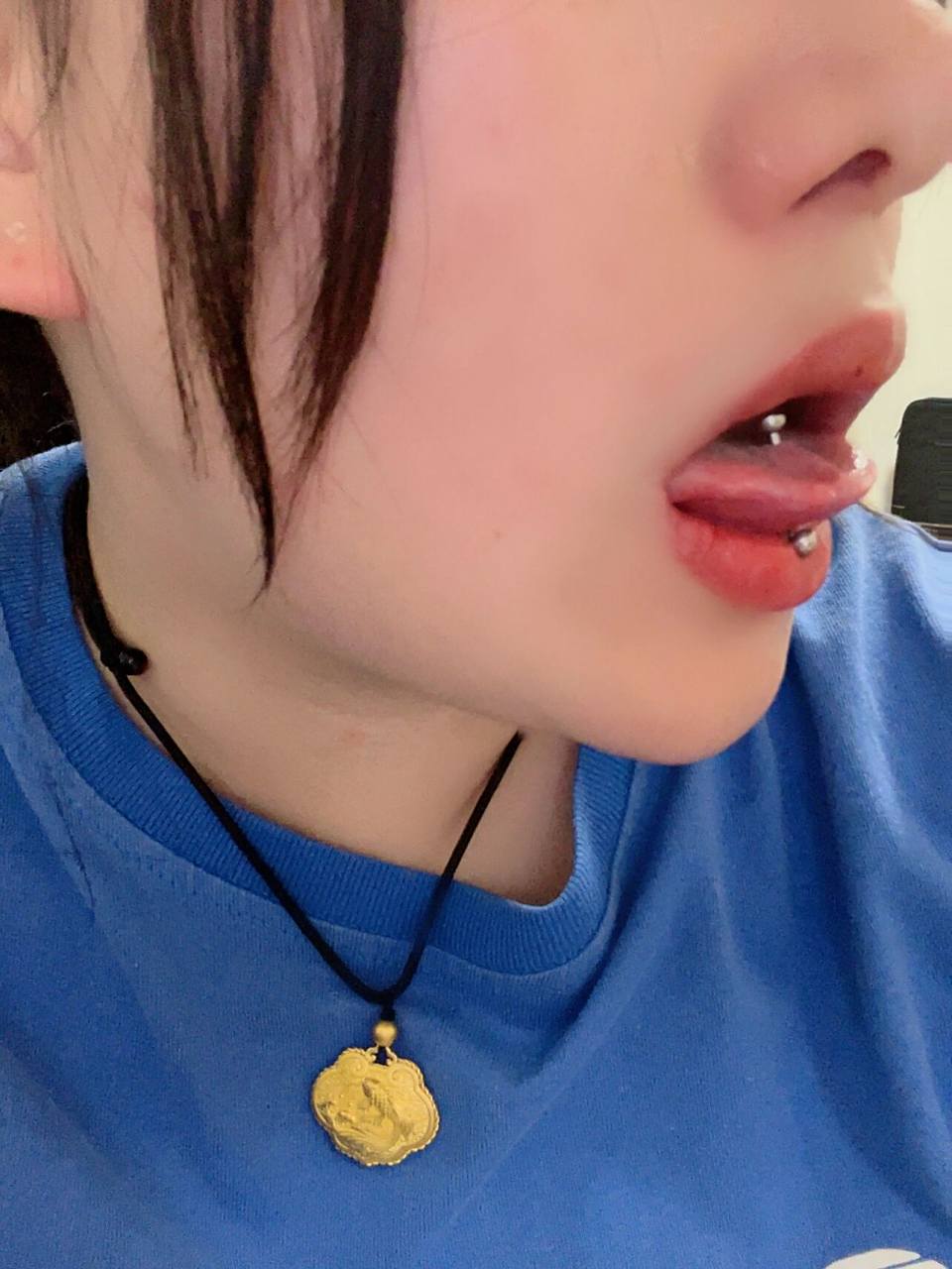 经验分享 打完舌钉如何快速恢复 舌钉注意事项!