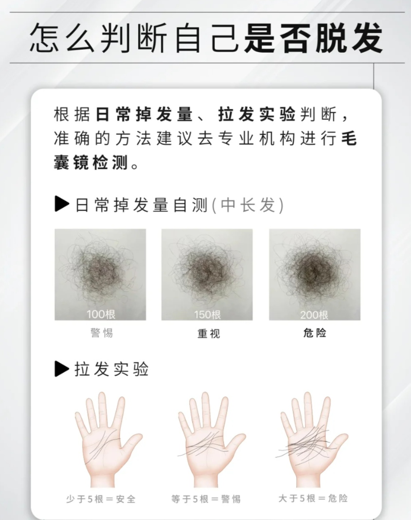 怎么样算脱发?