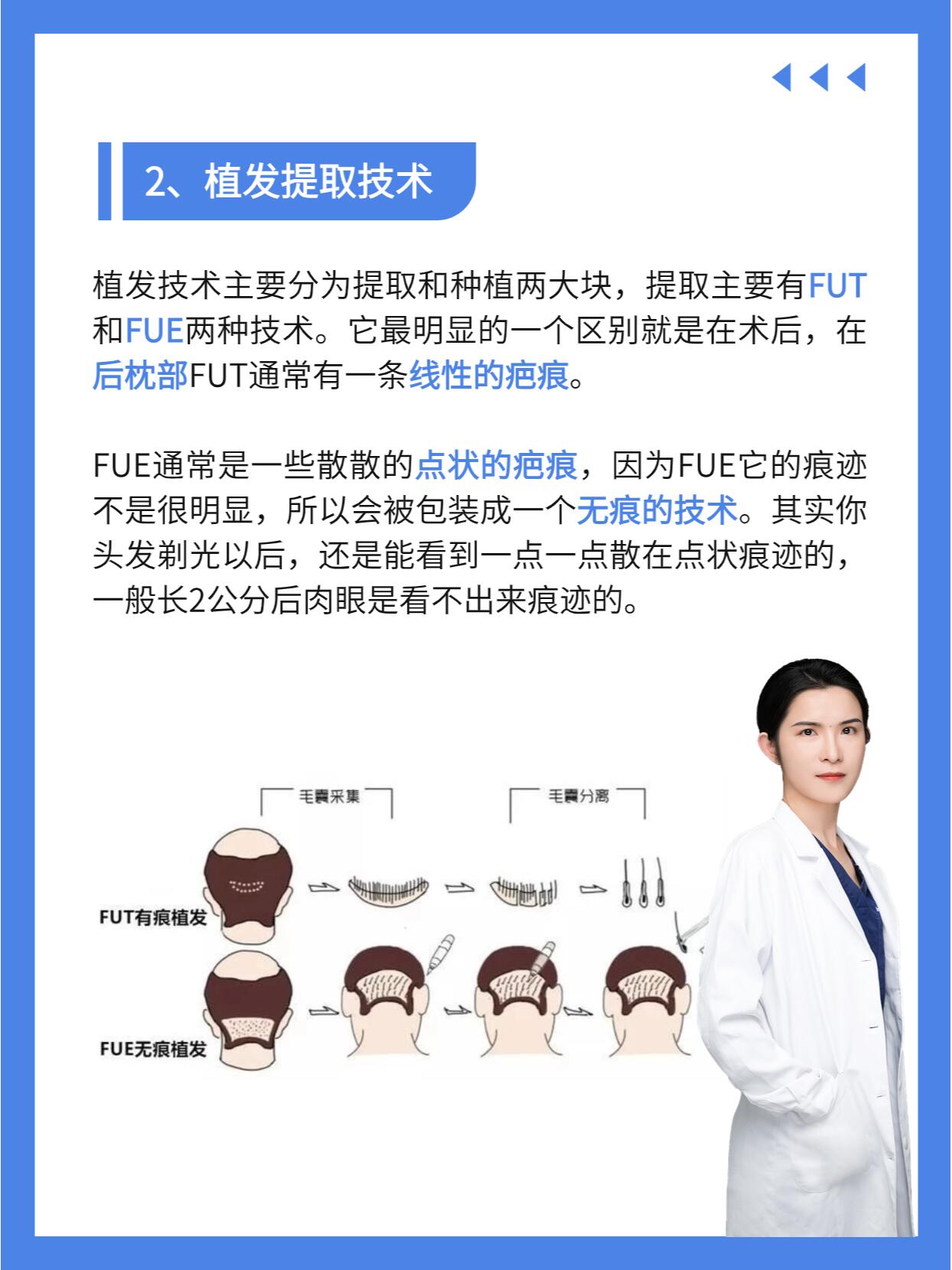 微针植发技术图片