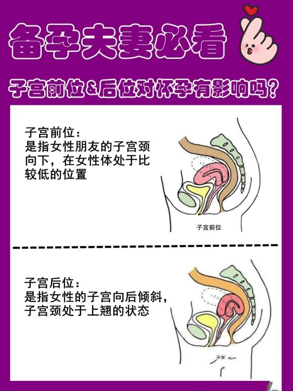 子宫后位受孕方法图片