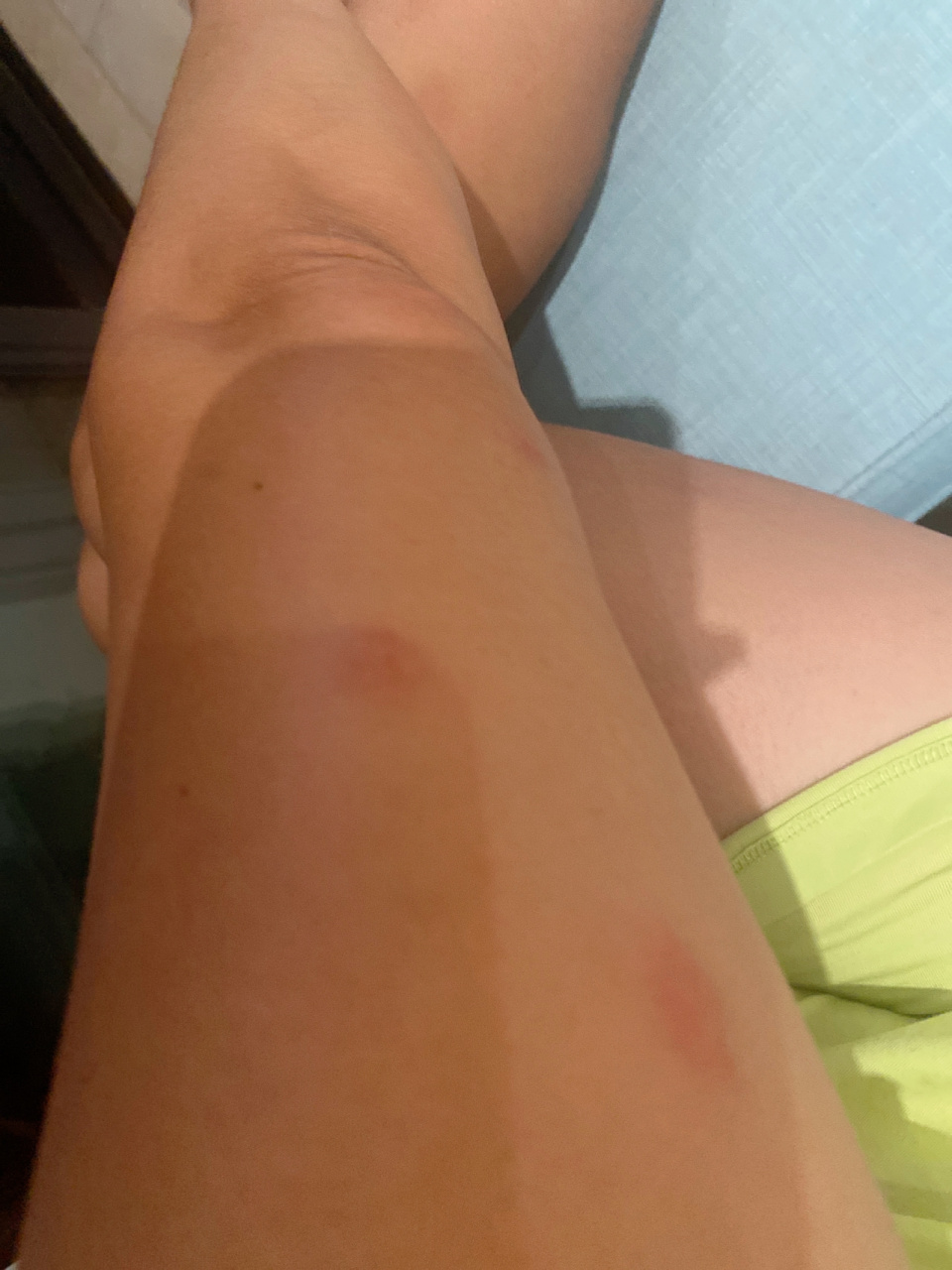 槟榔虫,我真的是服你～只要来海南年年被咬 和邻居去菜园采摘,连菜园