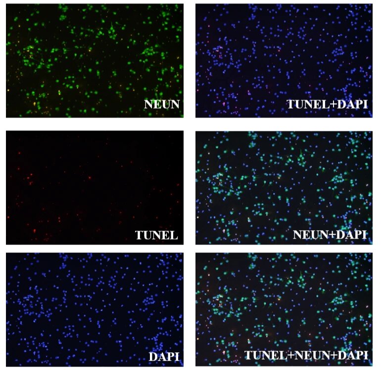 免疫荧光|贼难养的神经元染了tunel 这么多凋亡的红点点真得正常么?