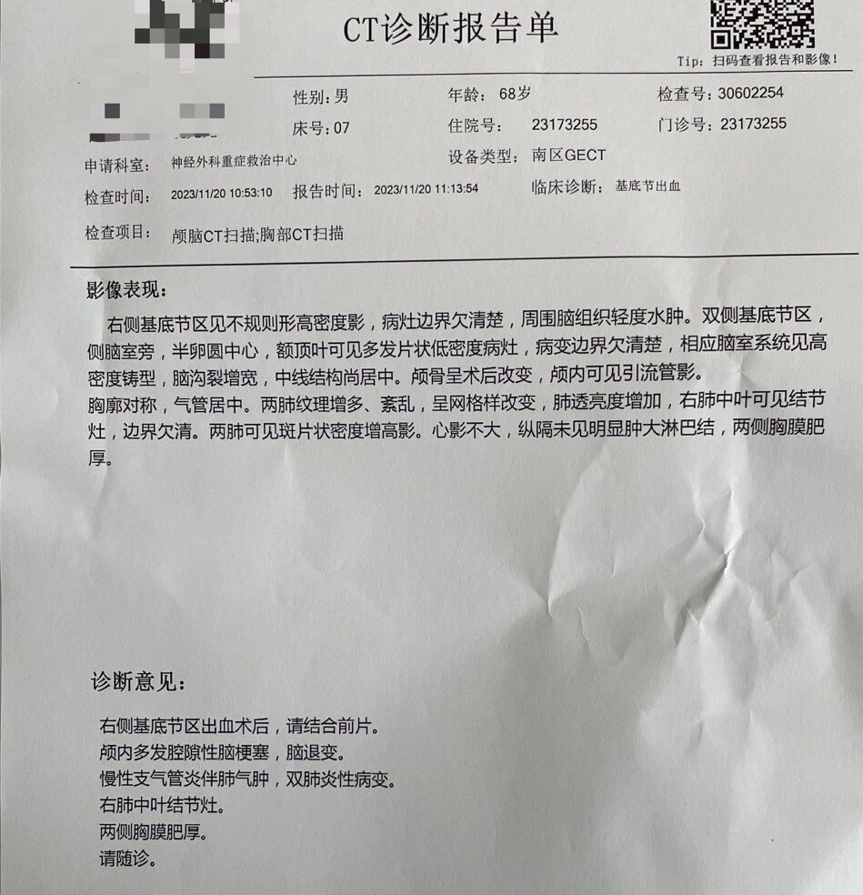 我爸右侧基底节出血20ml,这是两次微创手术之后一天的ct报告,现在重症