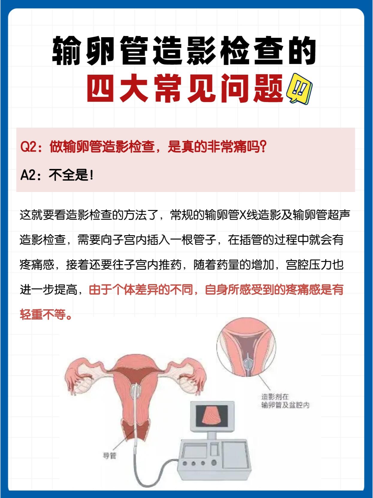 输卵管造影检查事项图片