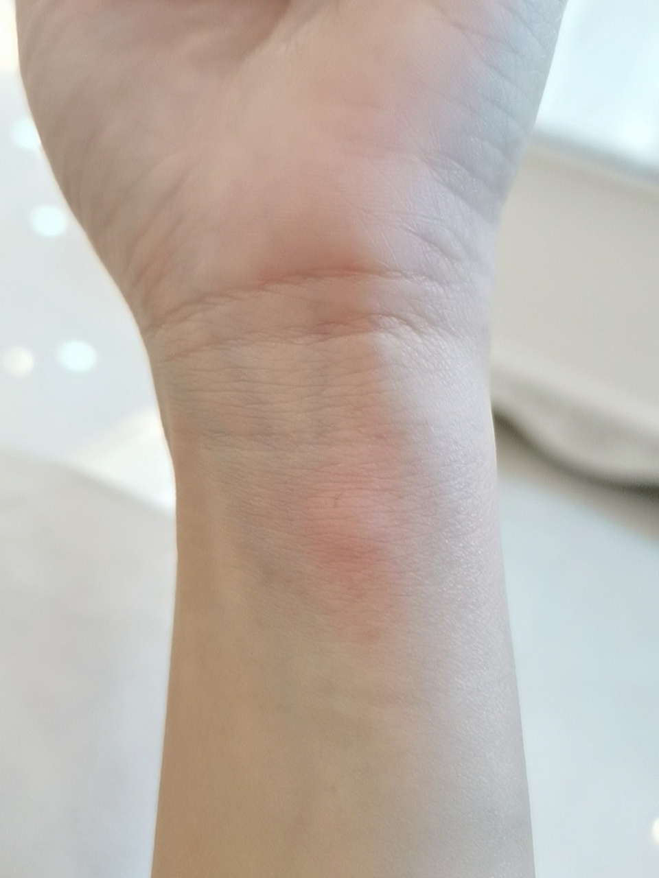 破伤风过敏 普通的马血破伤风做完皮试发红 我一直以为我不过敏 结果