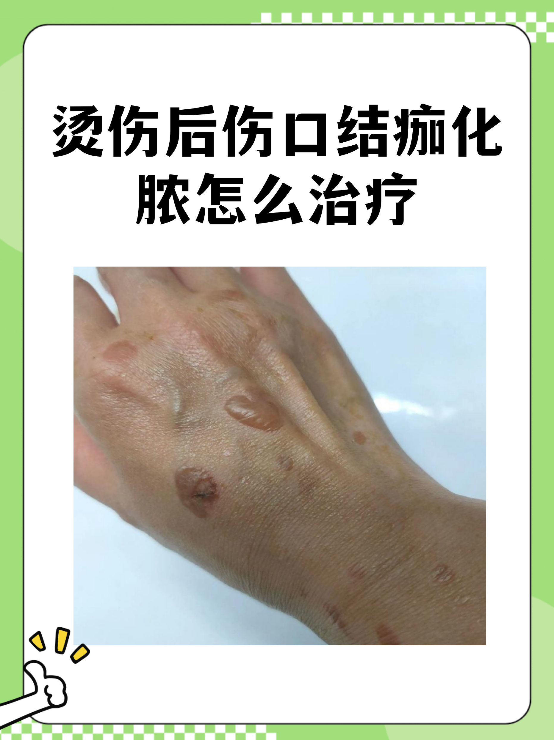原306医院异地就医陪诊代挂号术后伤口观察提醒,减少感染风险的简单介绍 原306医院异地就医陪诊代挂号术后伤口观察提醒,减少感染风险的简单介绍