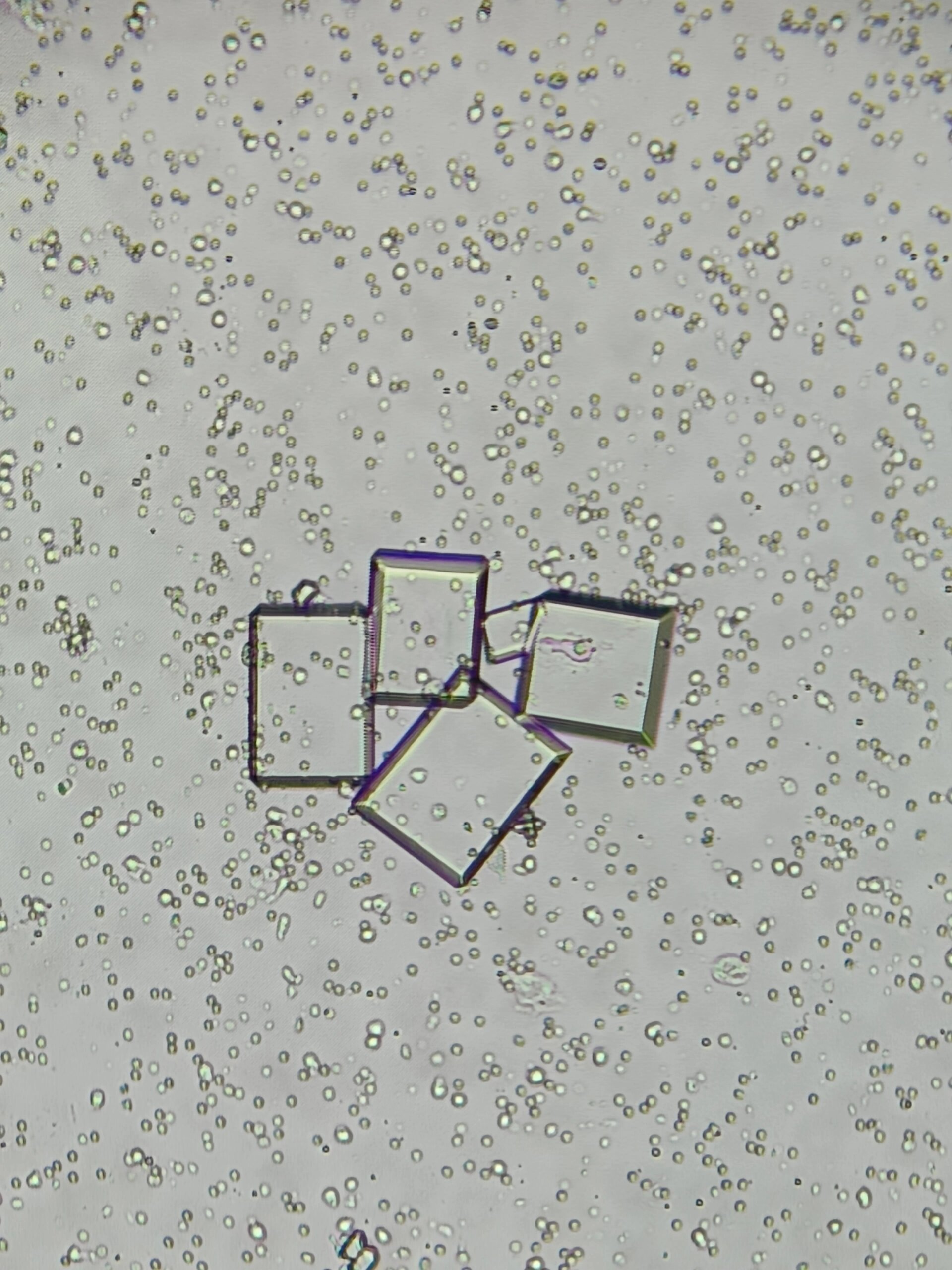 镜检〗磷酸铵镁结晶,又是你吗!