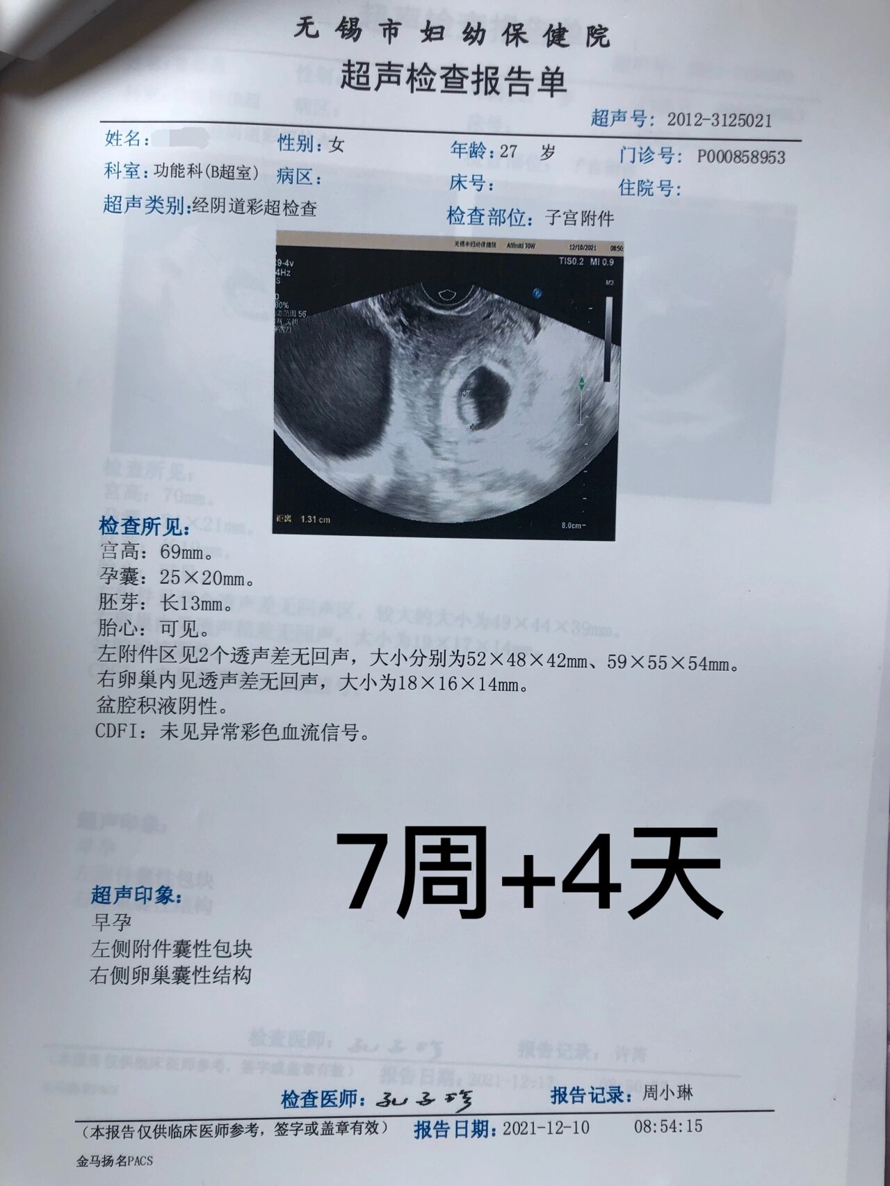 带囊怀孕的玻璃心妈妈 孕早期b超单