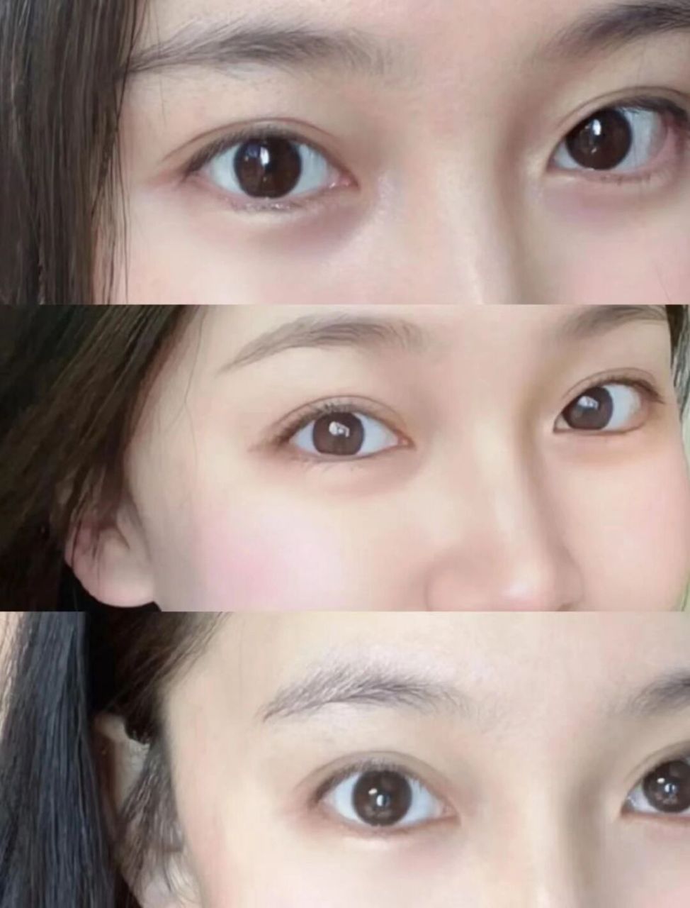 这简直是我的梦中情眼 平扇依旧自然～ #温州双眼皮# #黄乐双眼皮