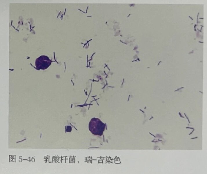 白带镜下乳酸杆菌形态
