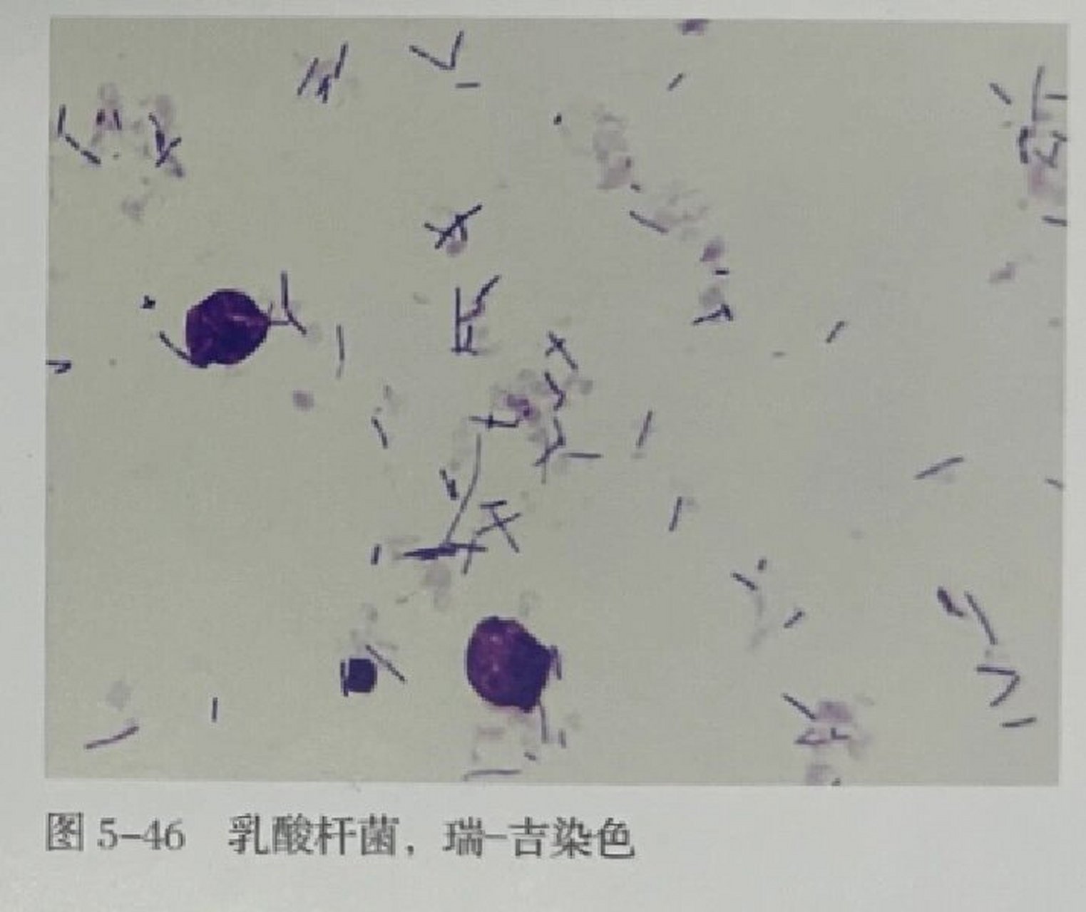 白带镜下乳酸杆菌形态 每个人心中的形态都不一样 终于有图解答了