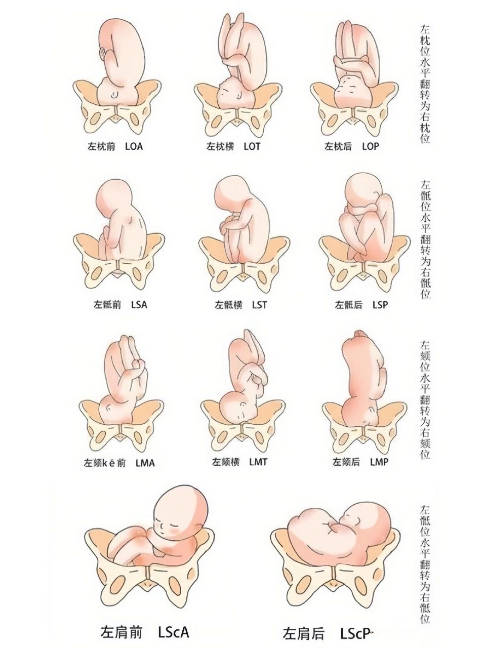 孕32周胎心位置示意图图片