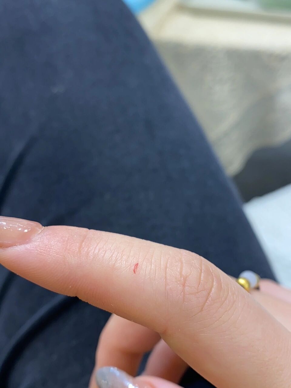 被家养猫猫的爪子一下子勾破了,用酒精喷了之后流了一点血