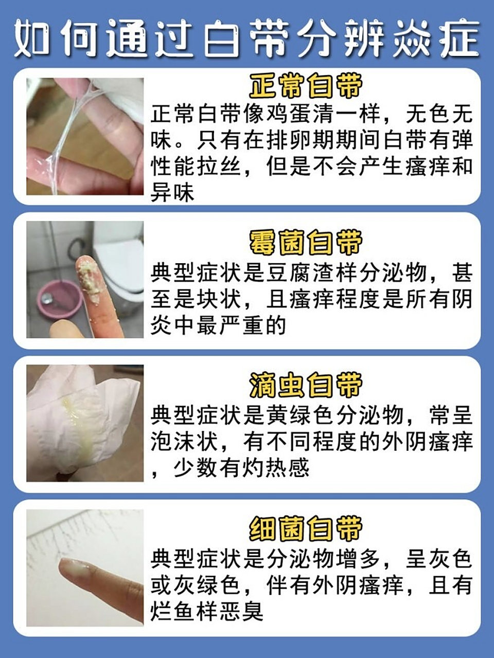 这样的白带,让我又尴尬又难受 我被妇科病折磨有大半年了,回想起来这