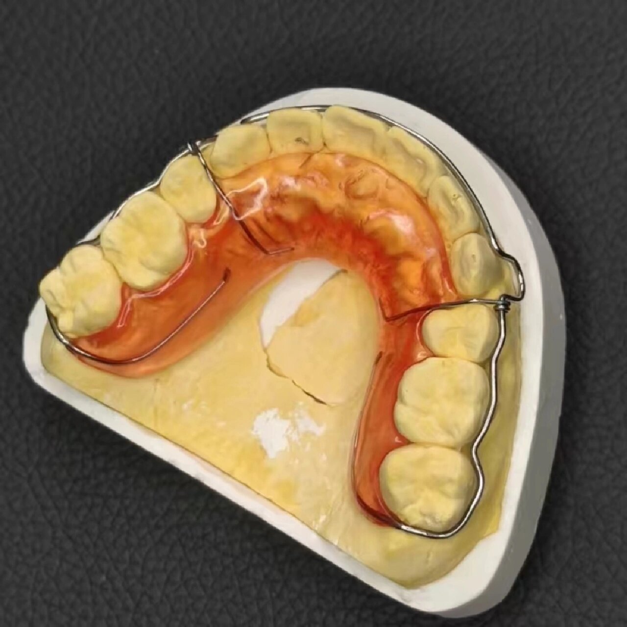 哈雷与比格保持器哪个效果好 哈雷与比格保持器 相同点: 两者都具有