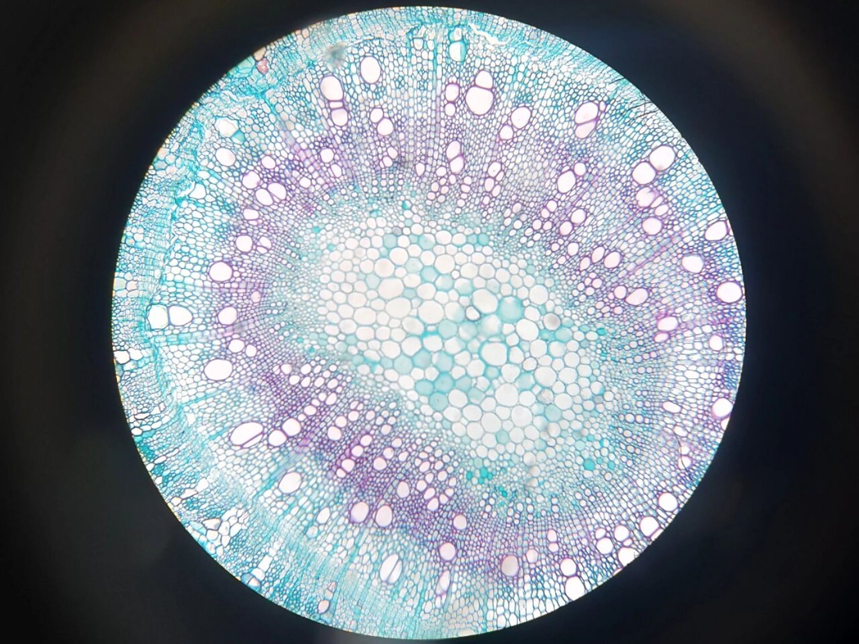 棉花老茎横切 植物学实验