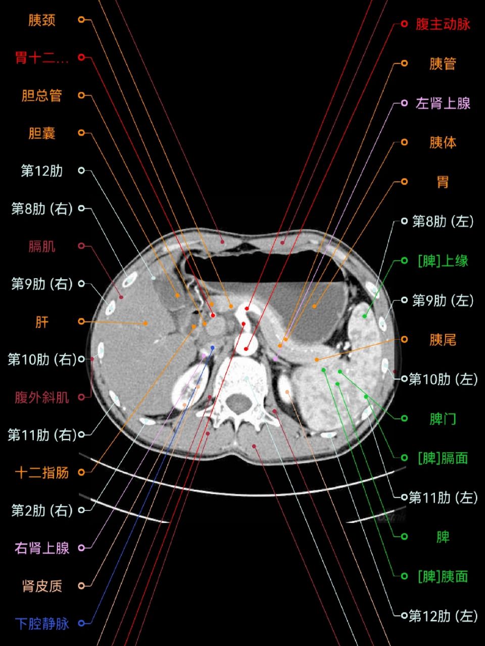 【影像解剖】腹部ct断层解剖图谱(app) 极力推荐的一个影像解剖学习