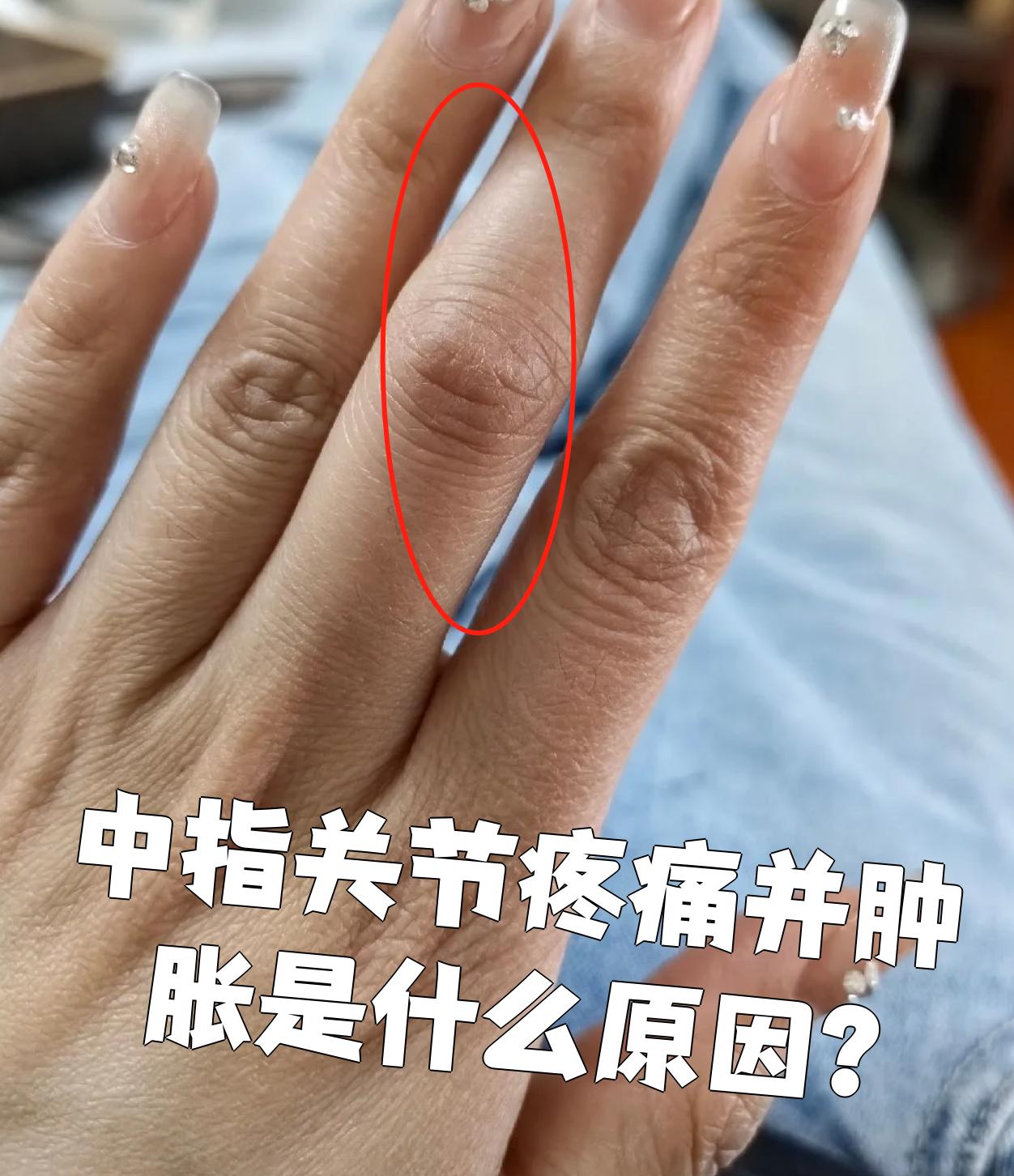 如果影响到手指关节,就