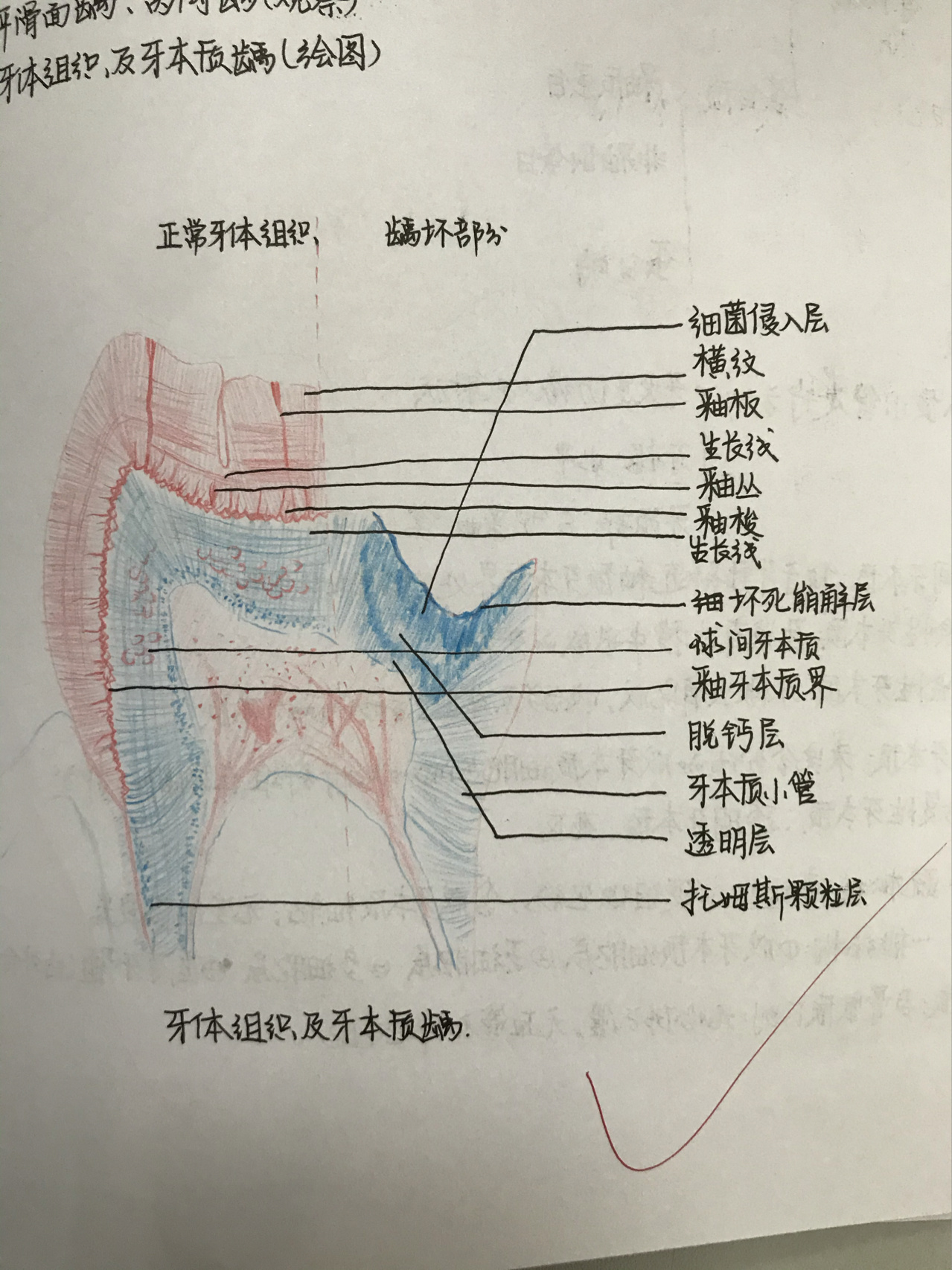 成牙本质细胞突图片