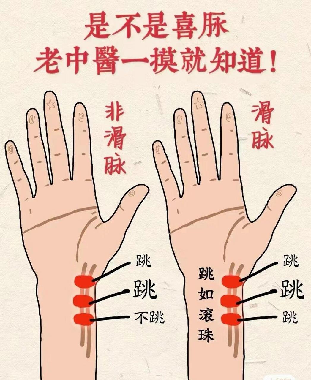 据说如果没有怀孕的话,月经要来也是这样的,真神奇 注意哦,给别人摸脉