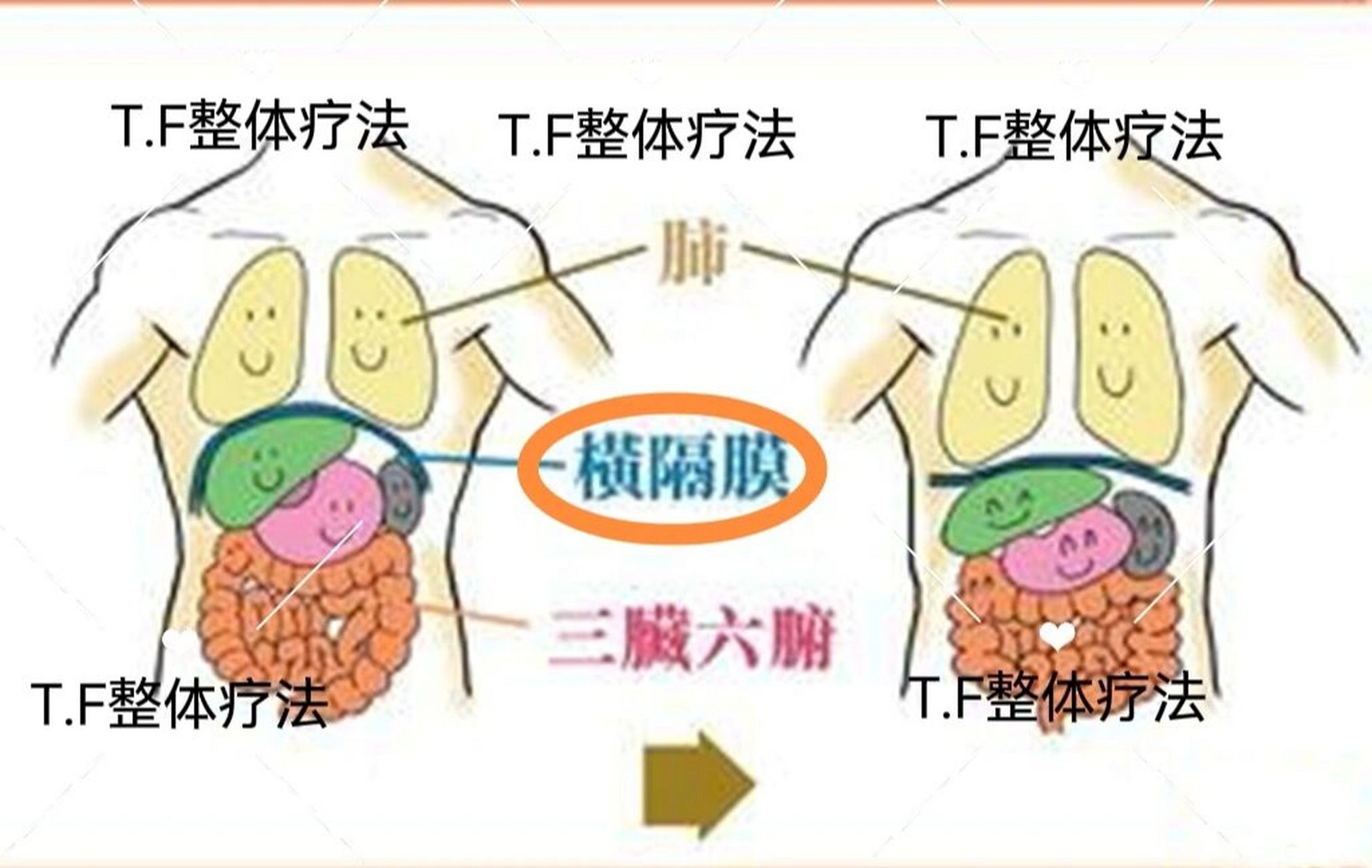 横隔膜肌图片