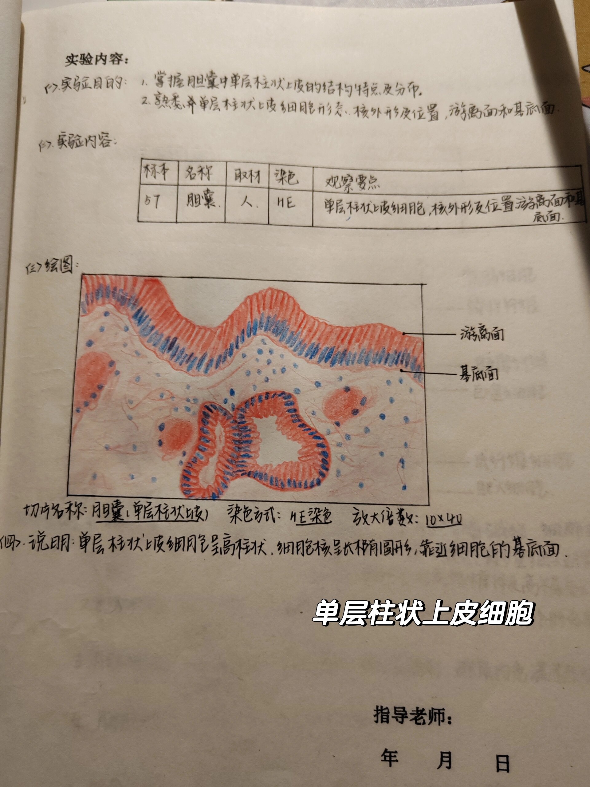 单层柱状上皮实验报告图片