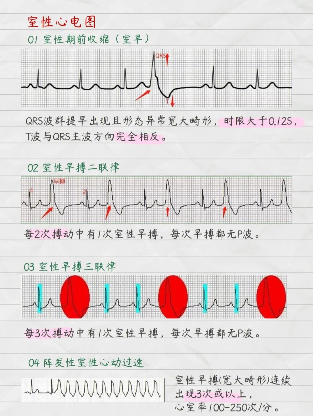 护理学生必备!关于心电图最全波形图