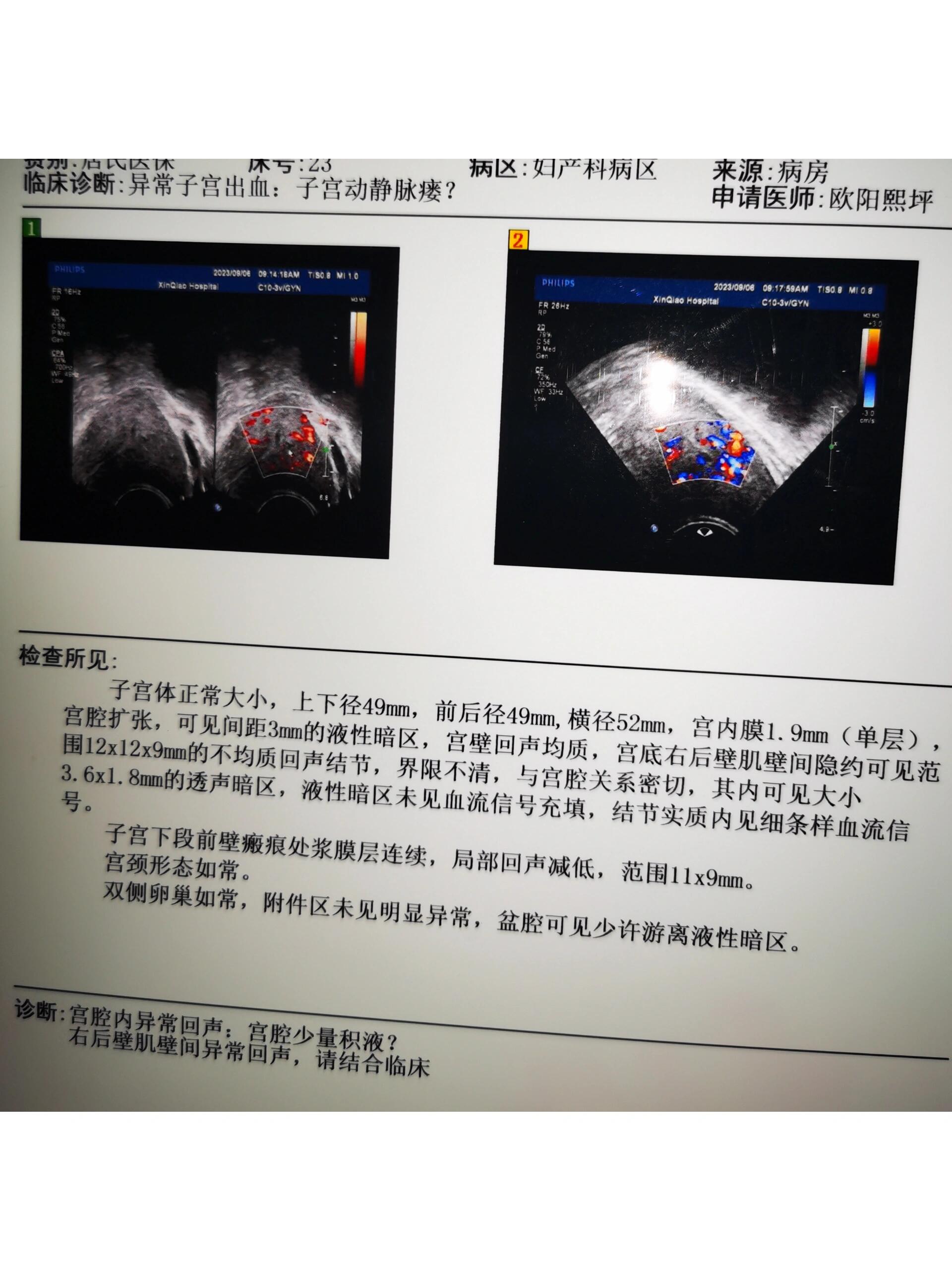 子宫大出血的真实图片图片