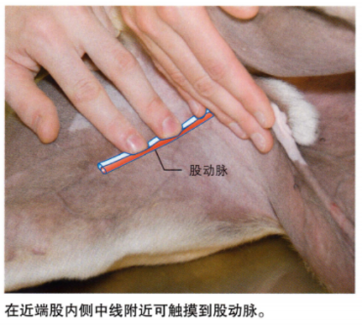 血液采集全知道③动脉血采集