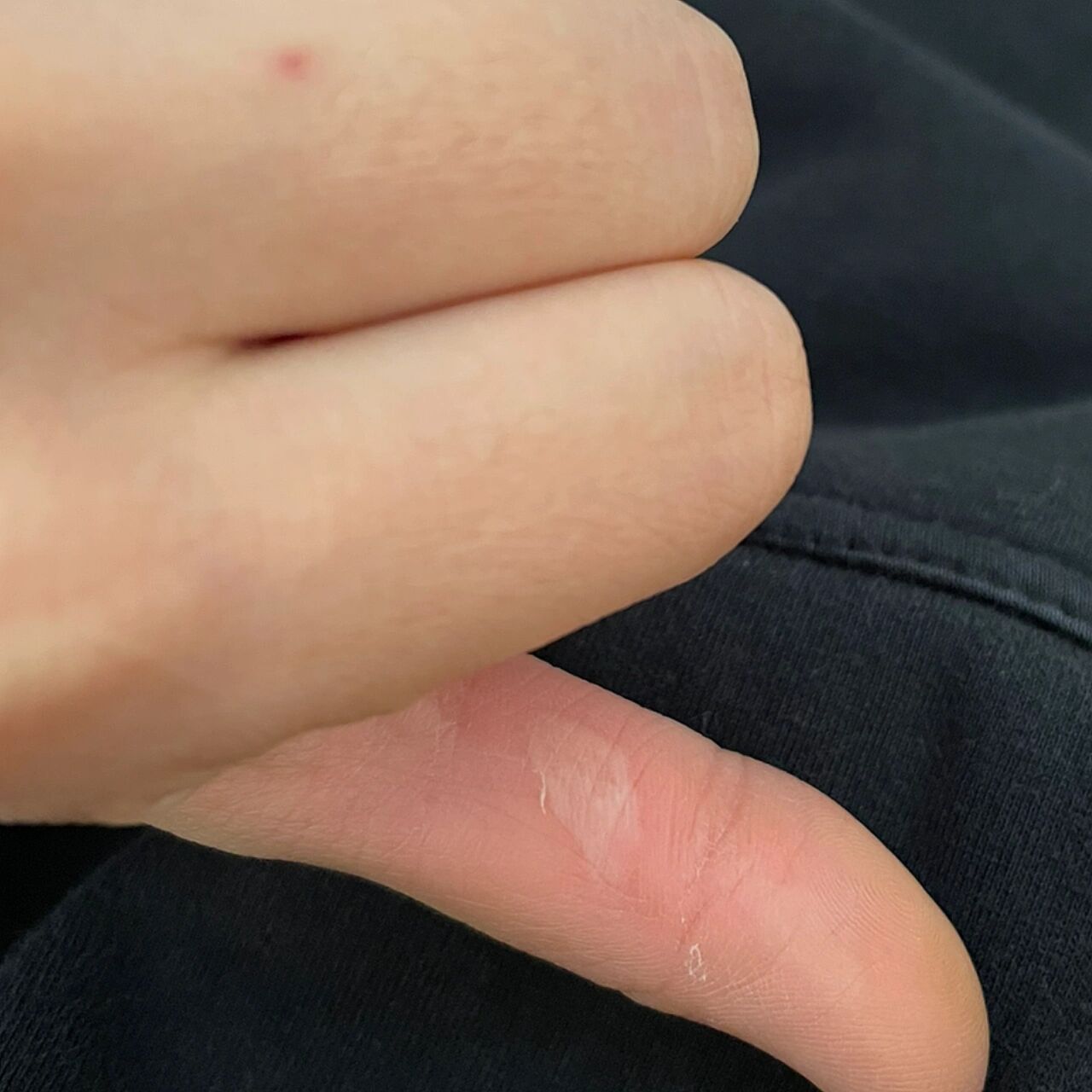 做环创用胶枪烫到了0101 真的好痛!