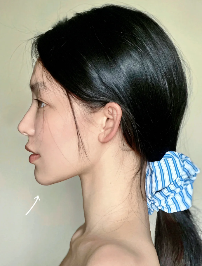 的侧脸好看侧脸侧面双下巴下巴突出侧脸难看图片双下巴侧面面部侧脸图