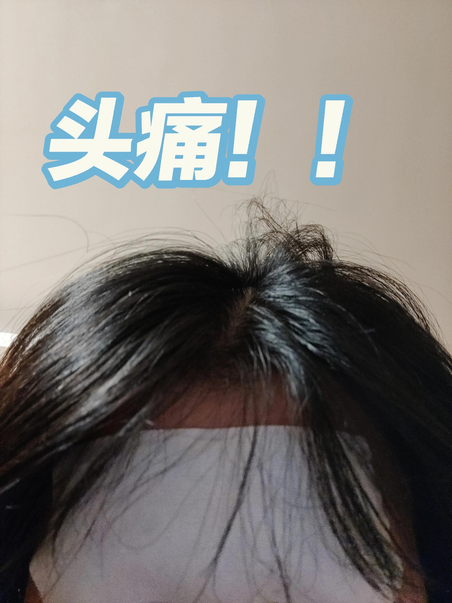 病急乱投医给我投对了 昨天发烧头疼欲裂,前额眼眶