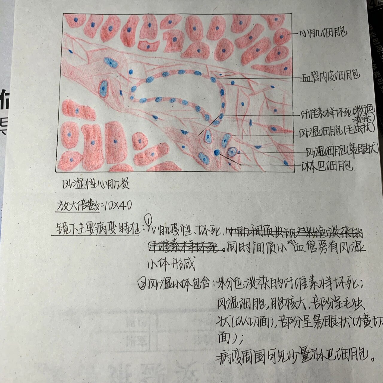 心肌红蓝铅笔图片