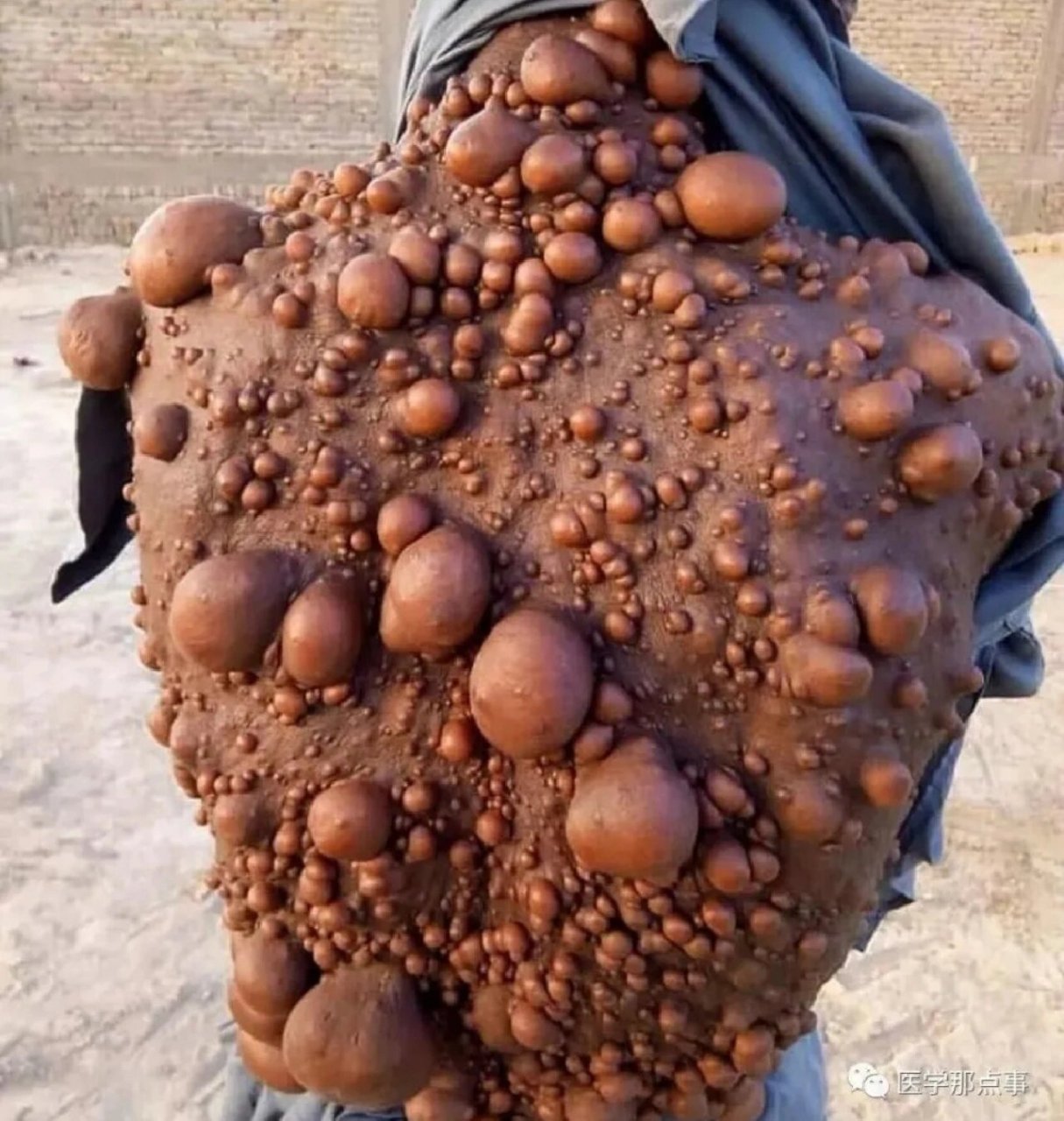 密集恐惧症恐怖图片,胆小勿进 密集#恐怖