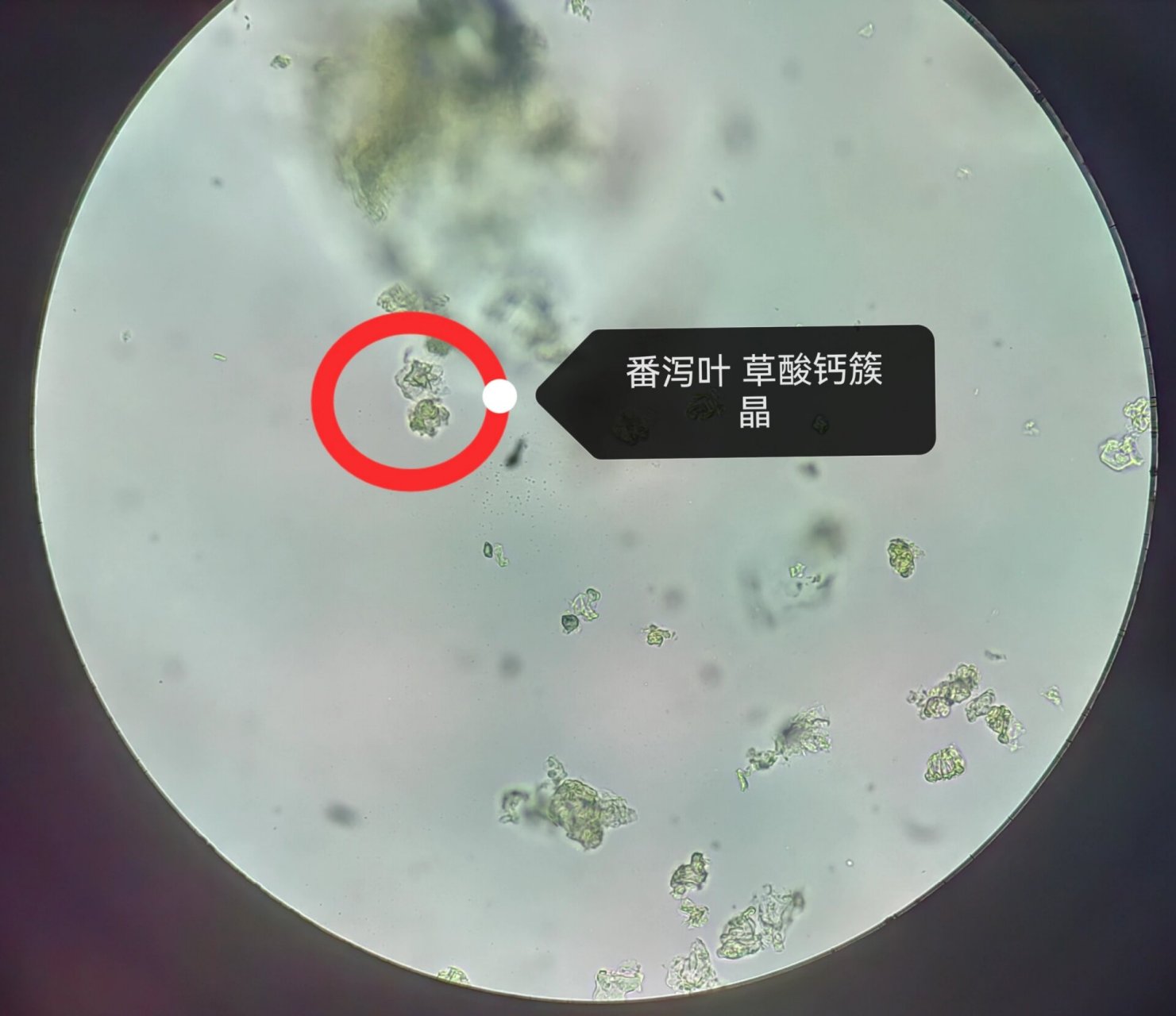 中药鉴定学实验(四) 番泻叶和金银花的显微鉴别