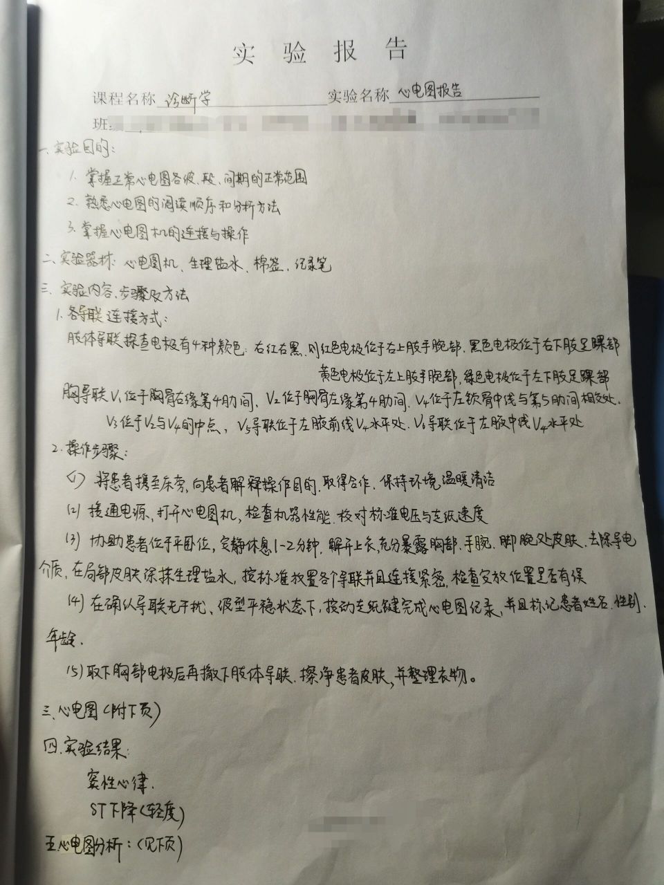 诊断学 心电图实验报告