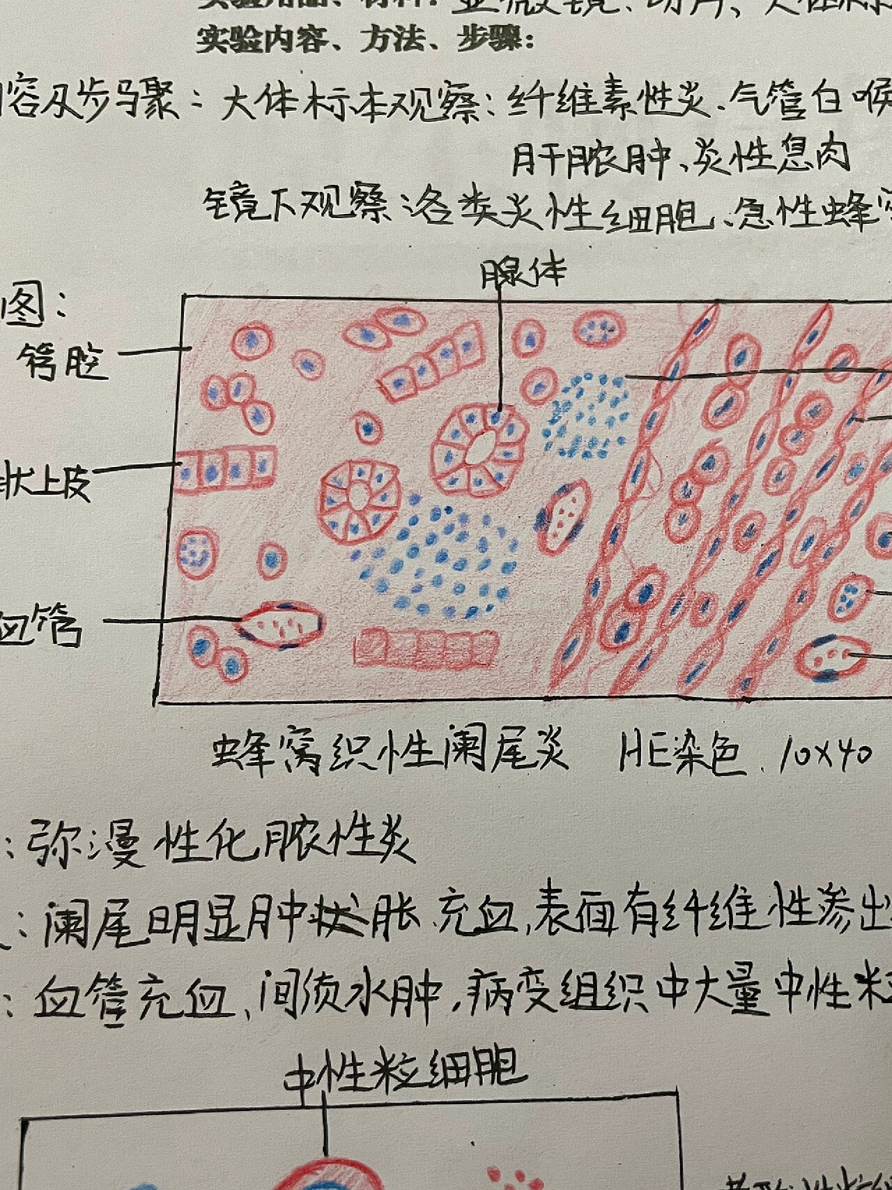 各种炎细胞图片