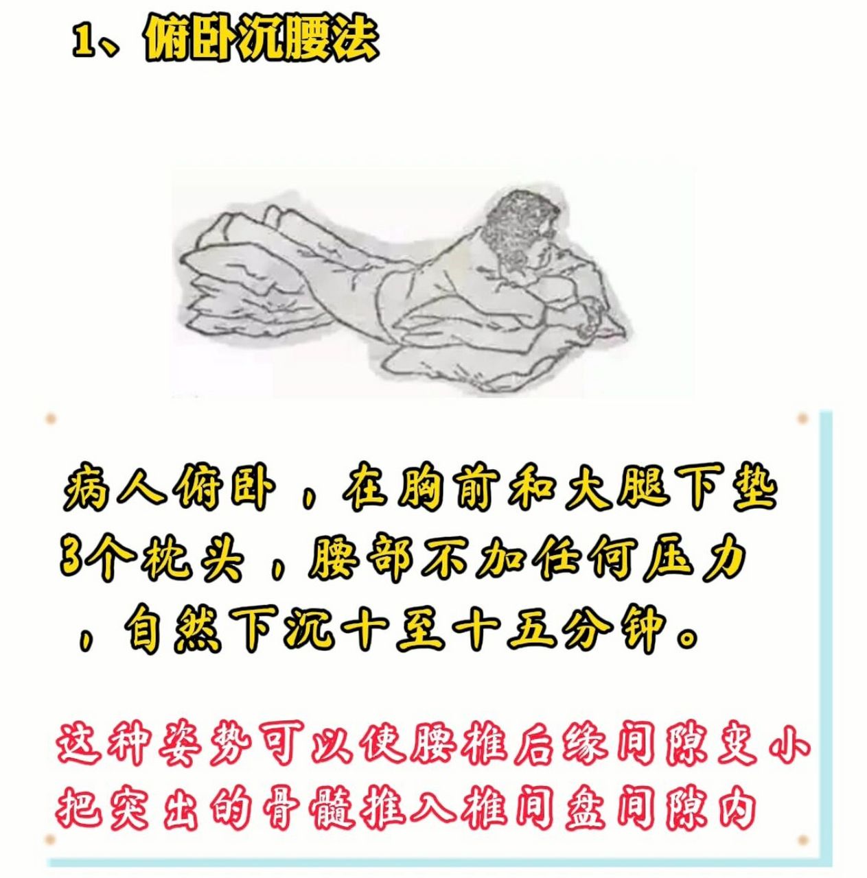 腰椎间盘突出——自我康复治疗 一,仰卧沉腰法 病人俯卧,在后背和屁股
