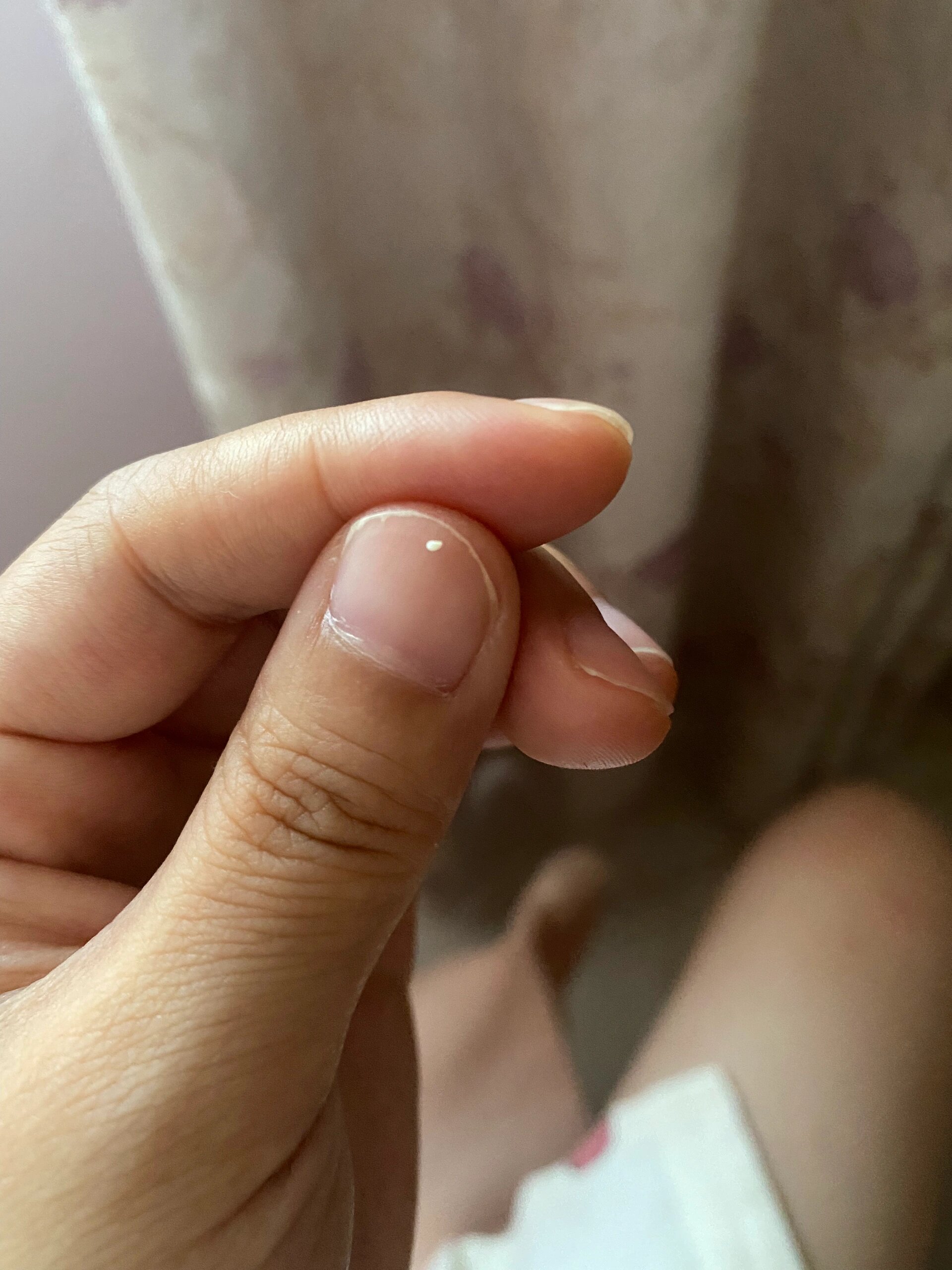 如何找到堵奶的小白点 总结每次堵奶的原因,我二胎之后都是因为奶眼堵