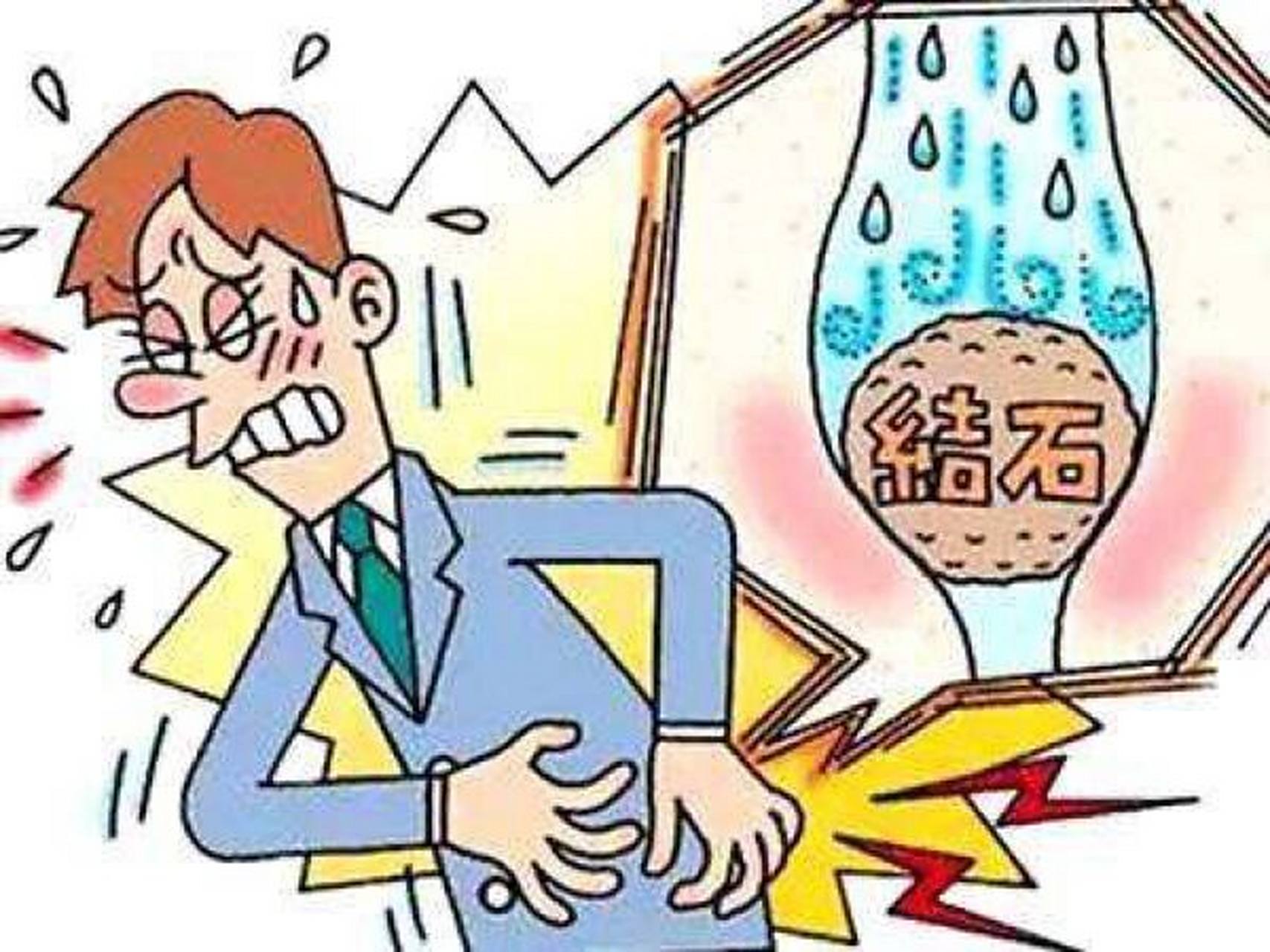 肾结石的疼痛就像一种酷刑 肾绞痛是肾结石最明显的症状,呈严重刀割样